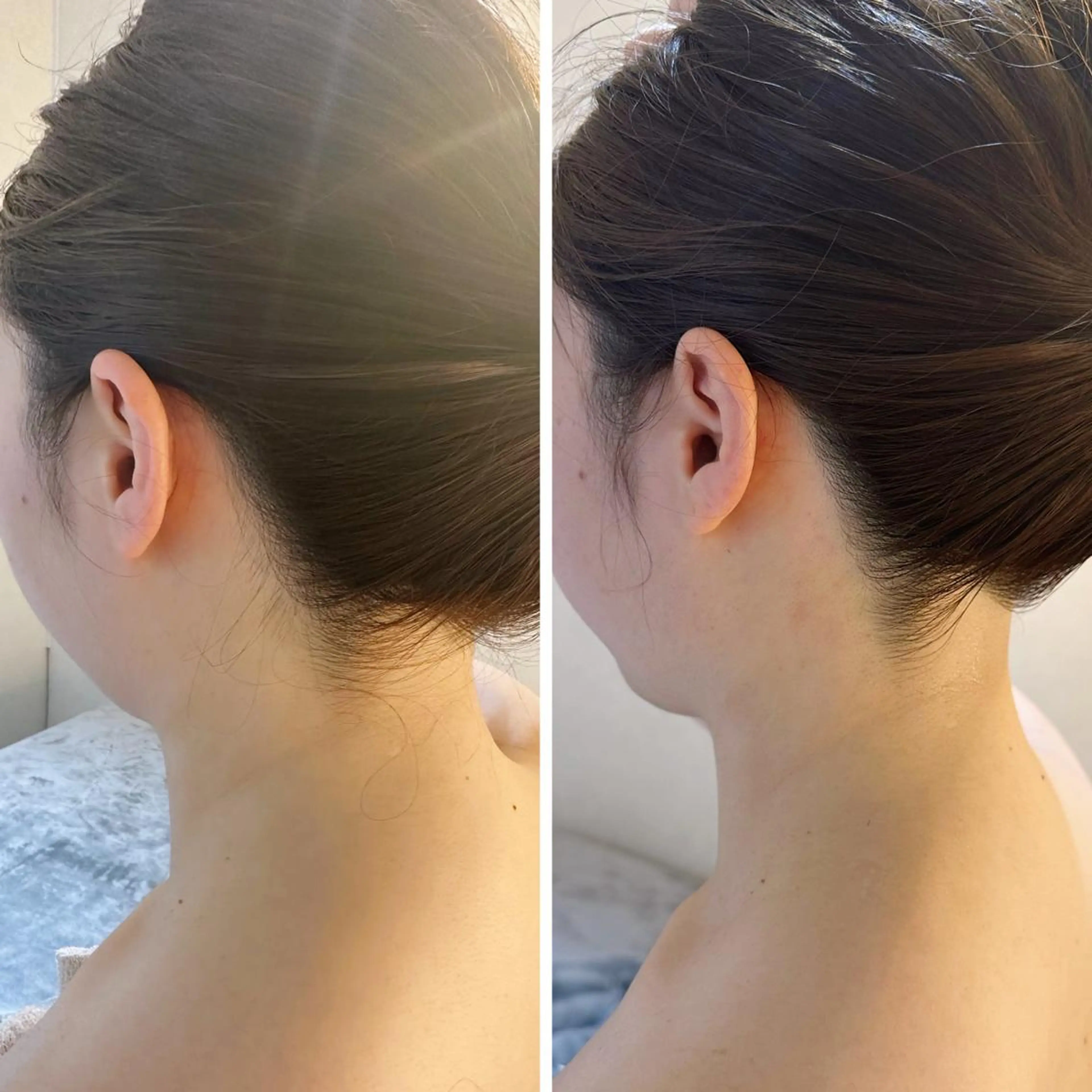 脱毛 うなじ脱毛/美肌脱毛 LABELのエステ・リラクイメージ