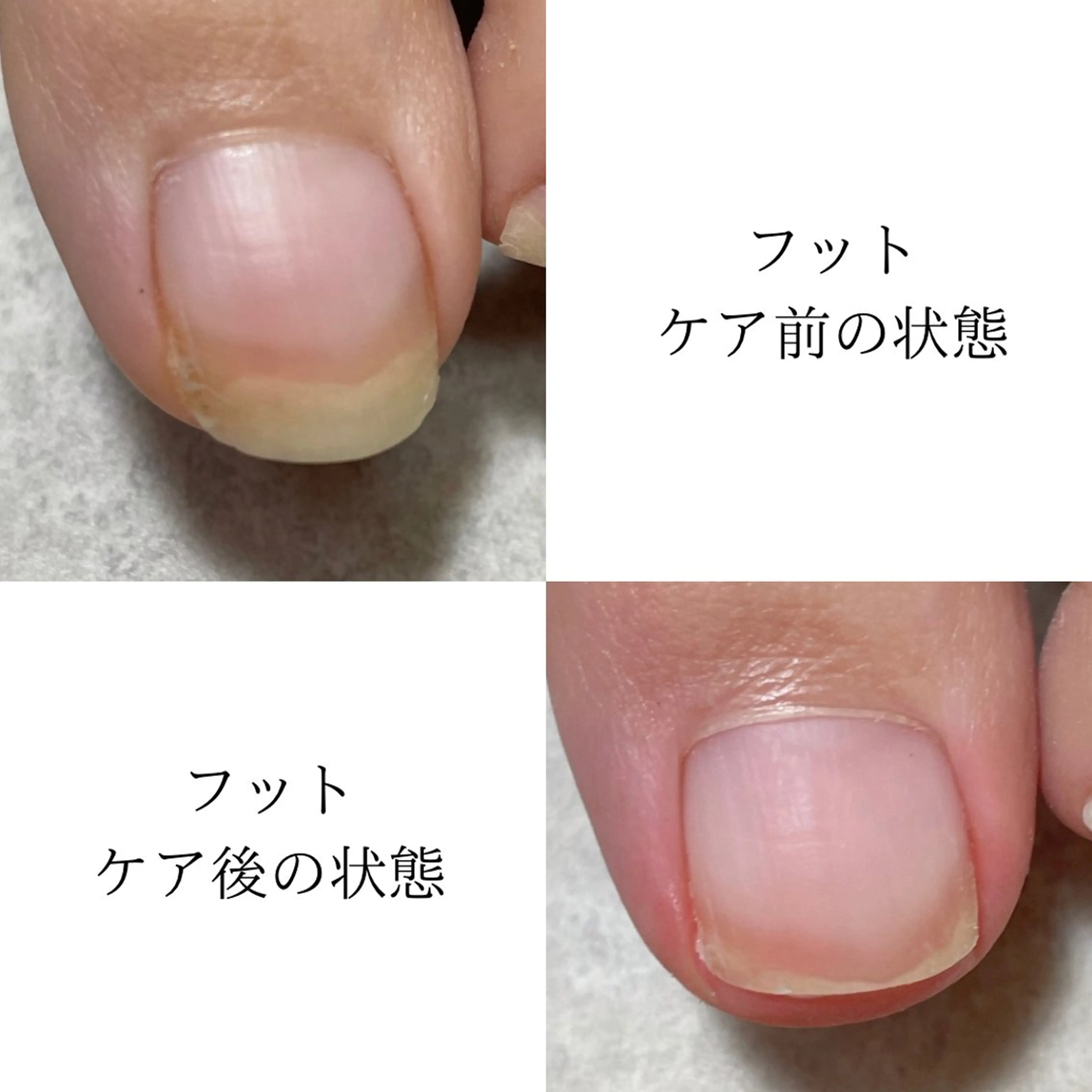 ネイル private salon alutのネイルデザイン