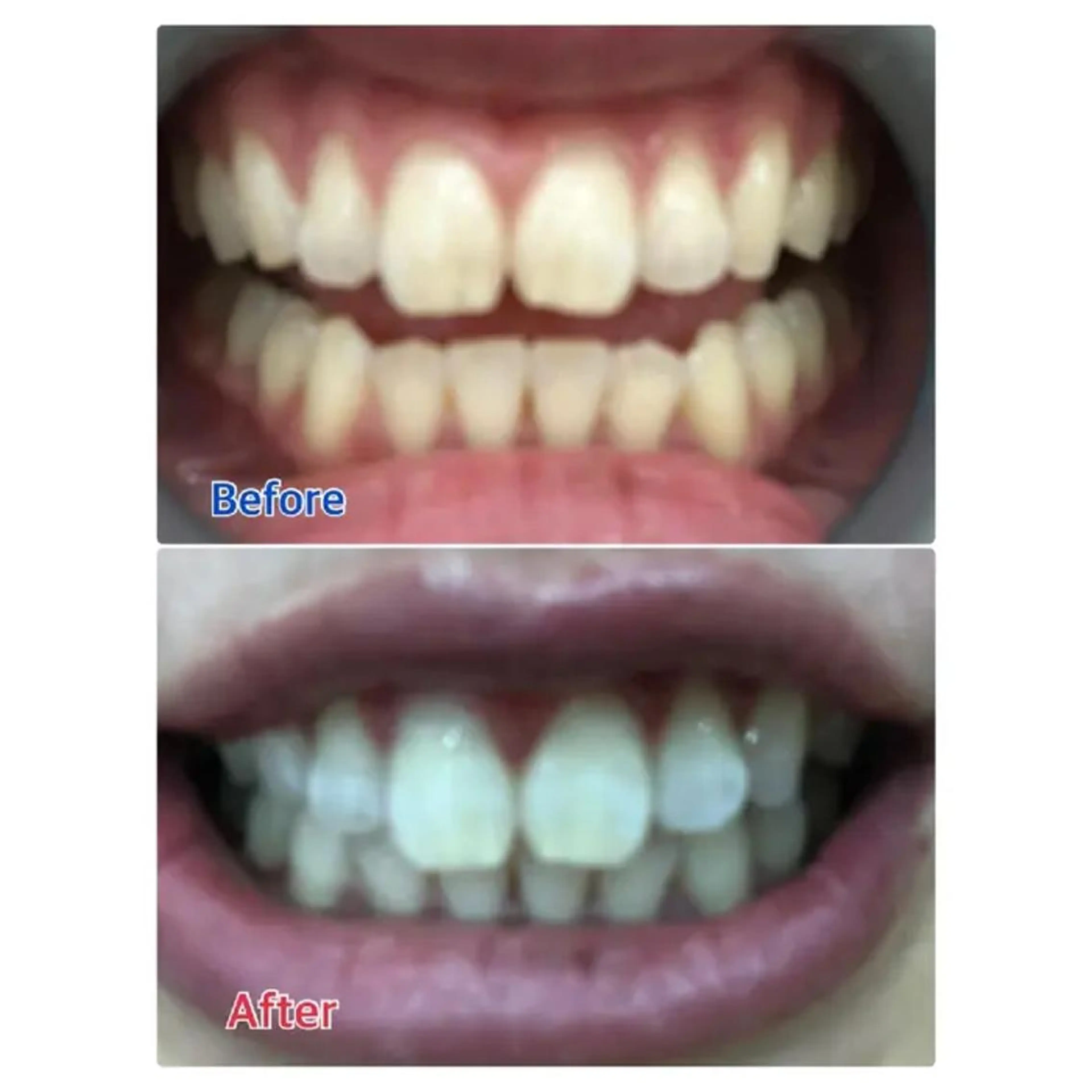 M渋谷 ホワイトニングのその他イメージ