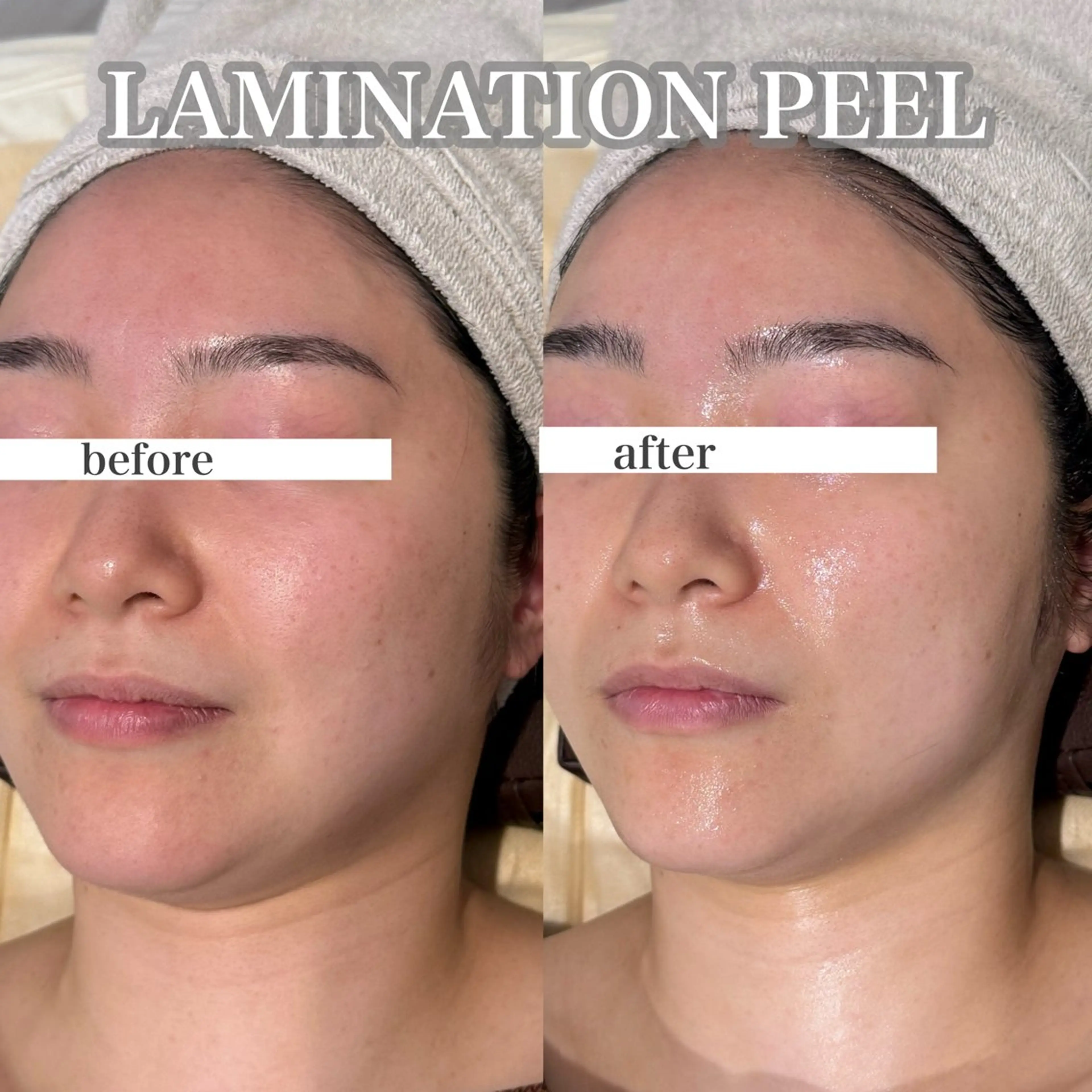 エステ 東大阪/韓国肌管理/ 痩身バスト専門店のエステ・リラクイメージ