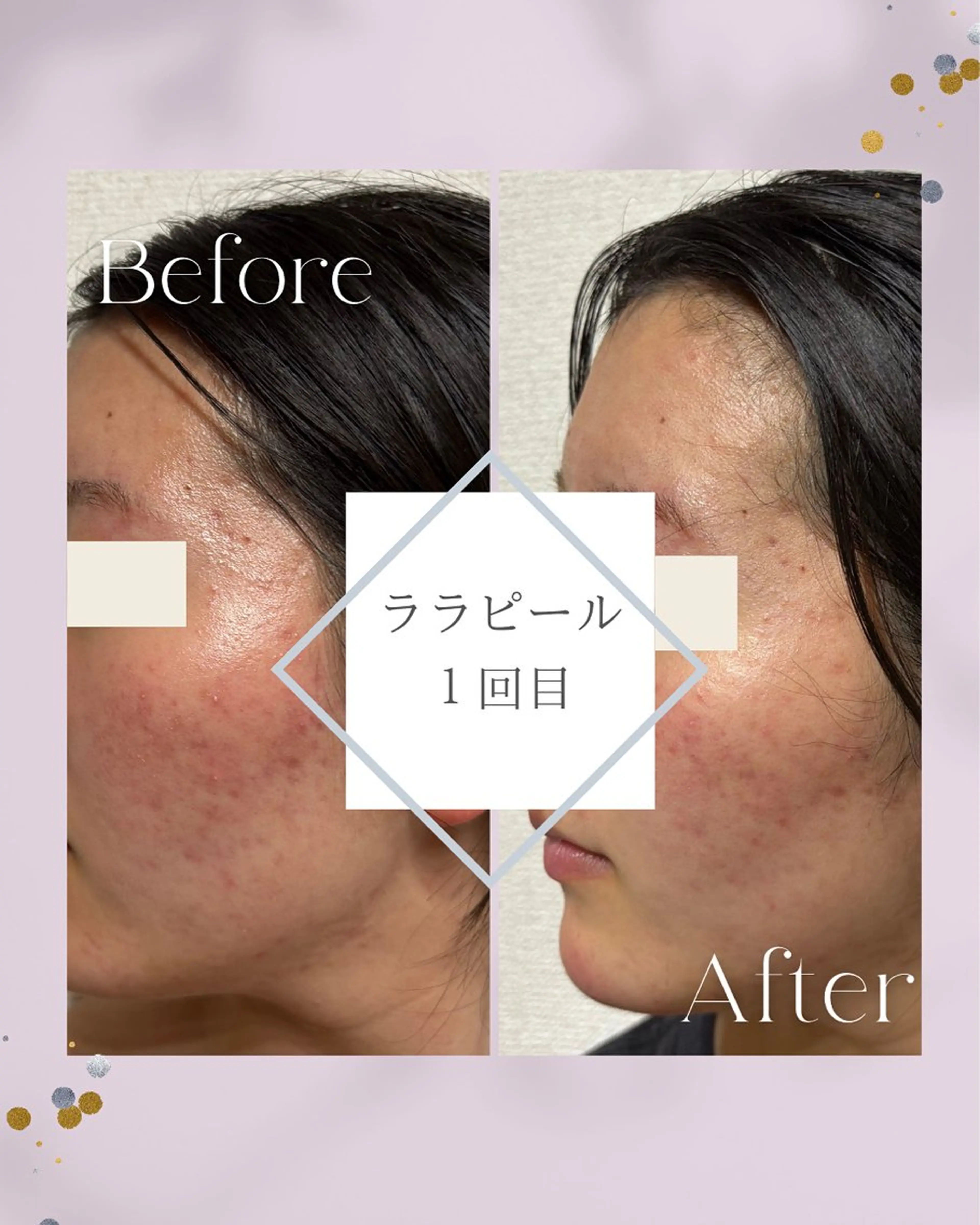 ainoa所属・ainoa アイノアのエステ・リラクイメージ