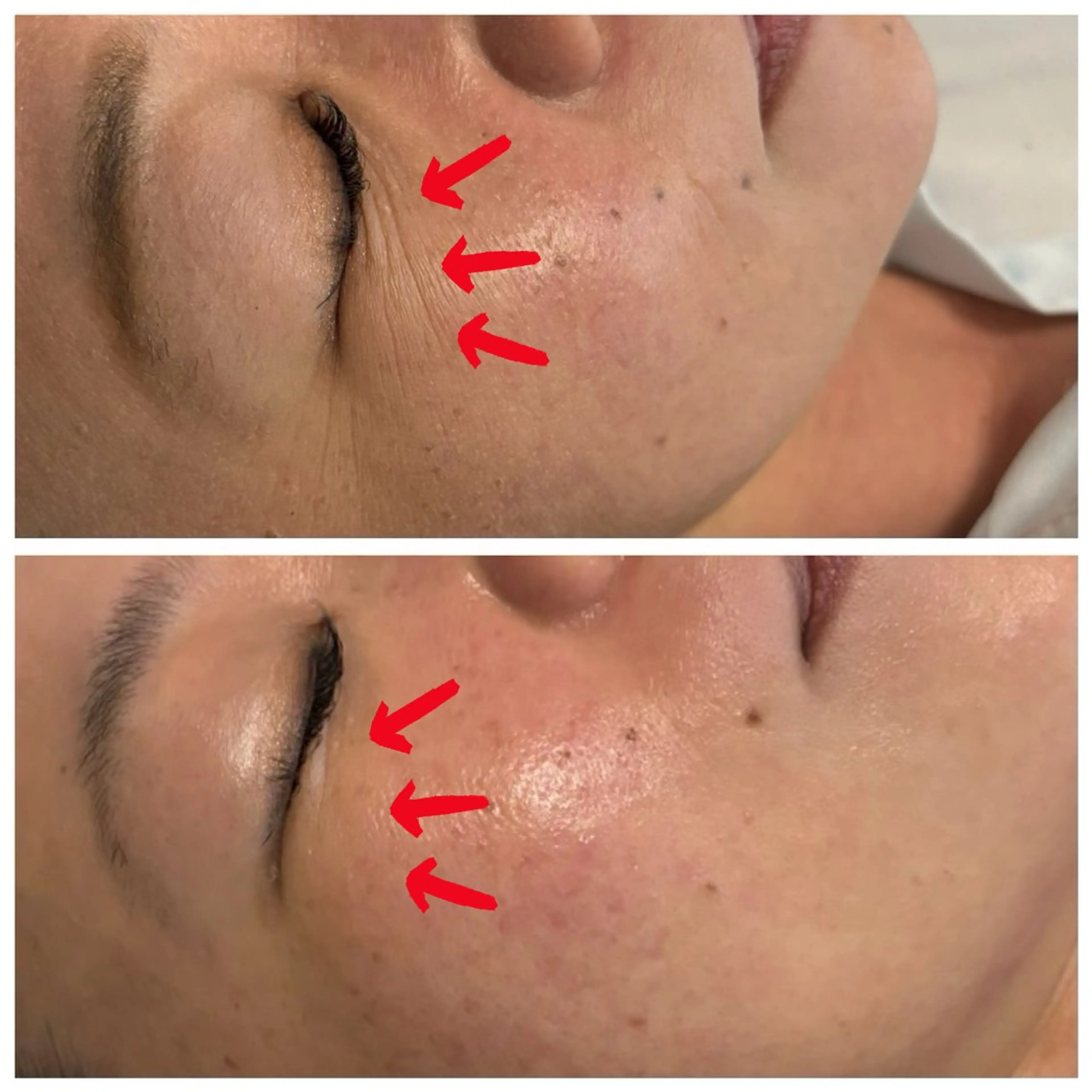 エステ リラク お手入れ眉/小顔 /プライベートサロンのエステ・リラクイメージ