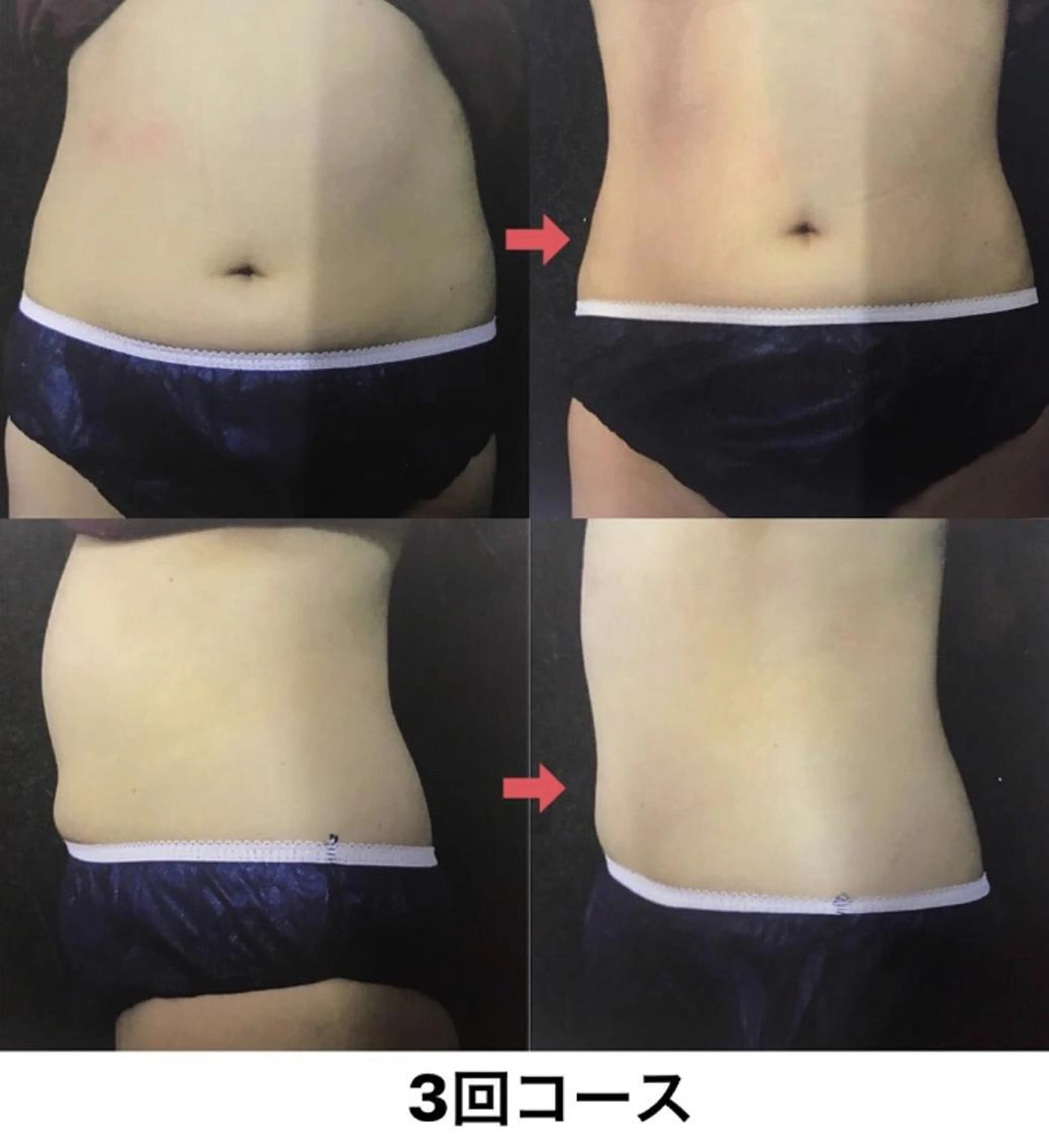 横浜エステサロン R-ing　リングのエステ・リラクイメージ