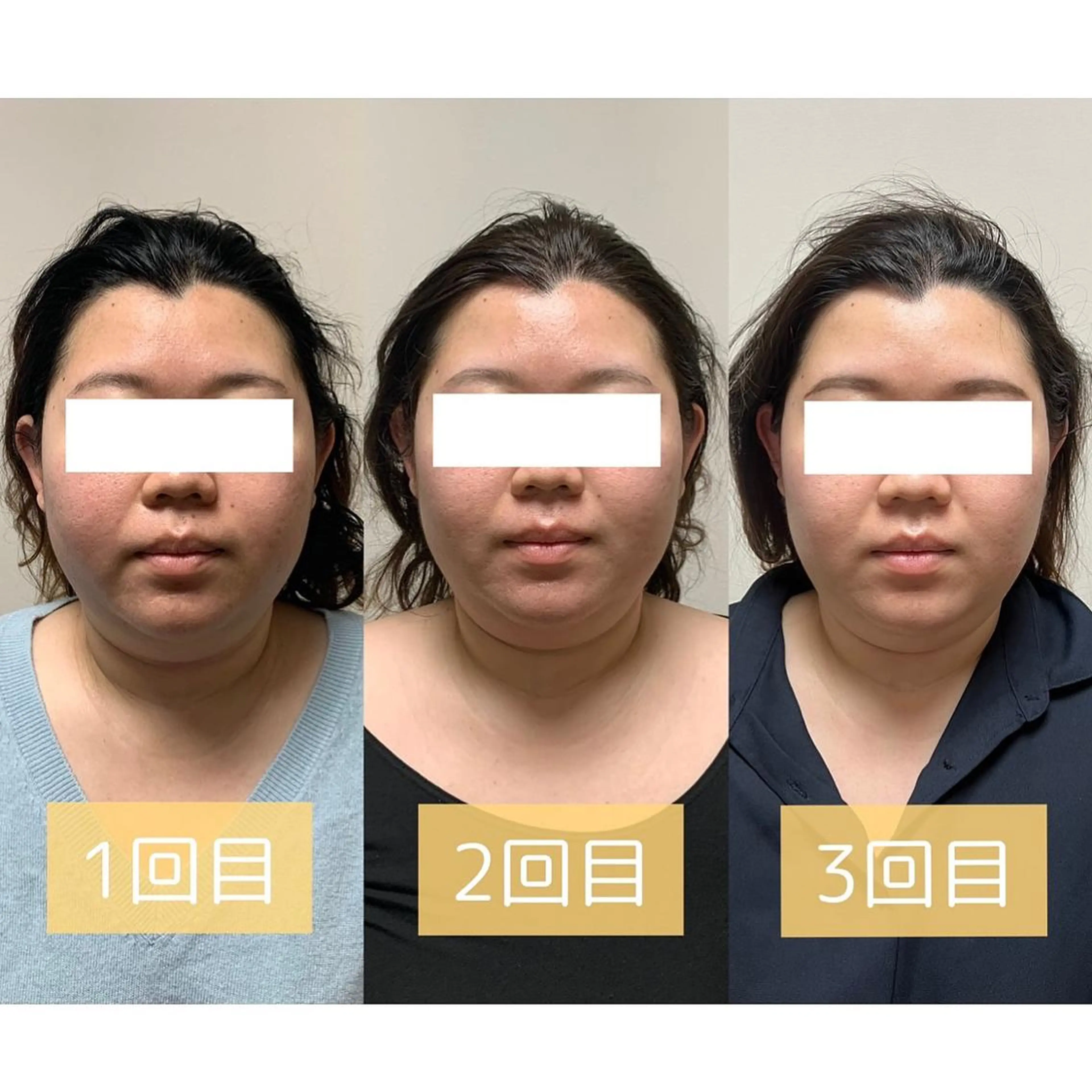 脱毛専門サロン BELFINE恵比寿のエステ・リラクイメージ