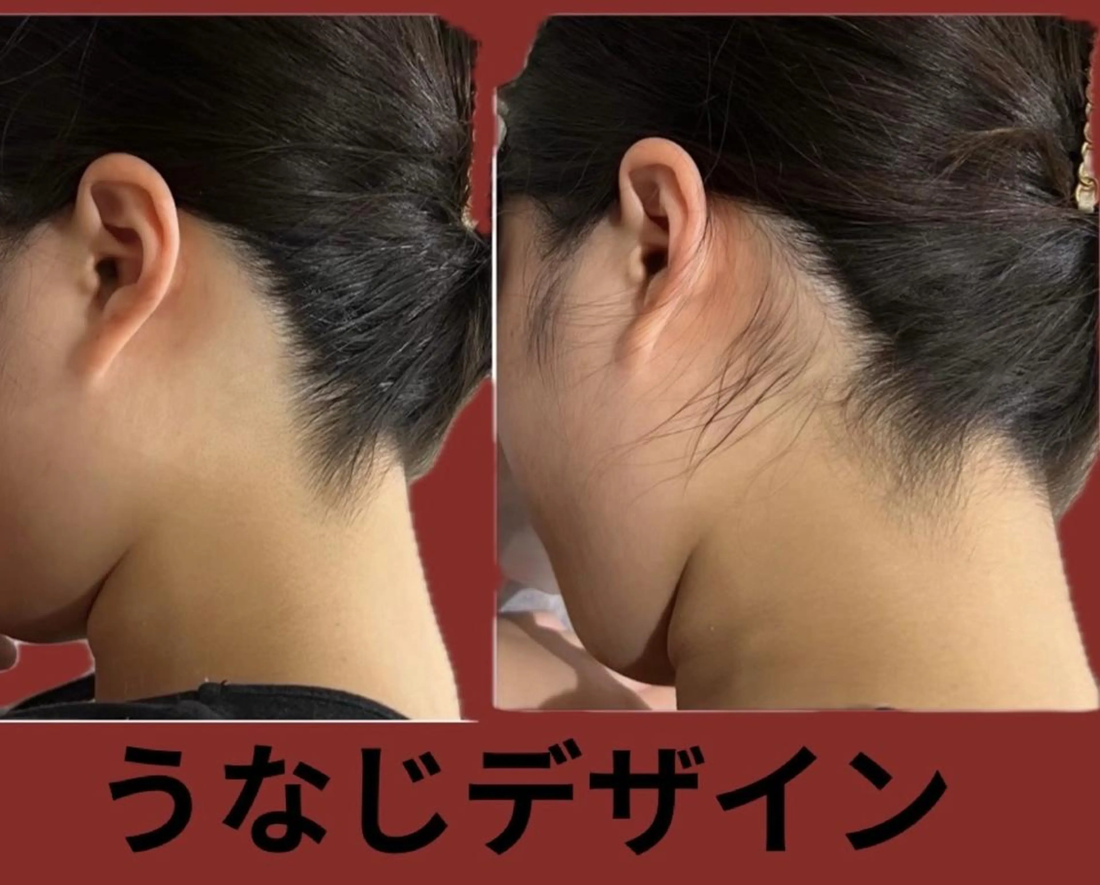 脱毛 メディカルエステ マドンナ富士宮店のエステ・リラクイメージ