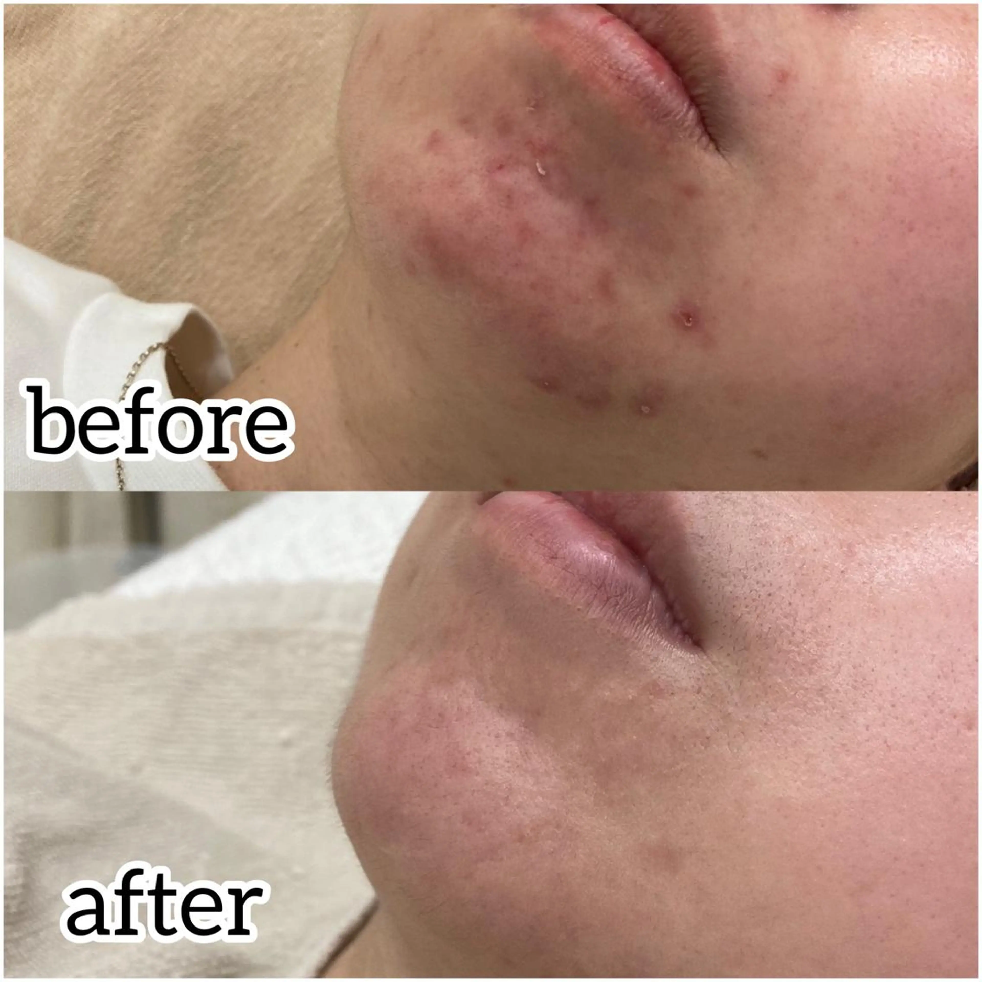 laluna saki...のその他イメージ