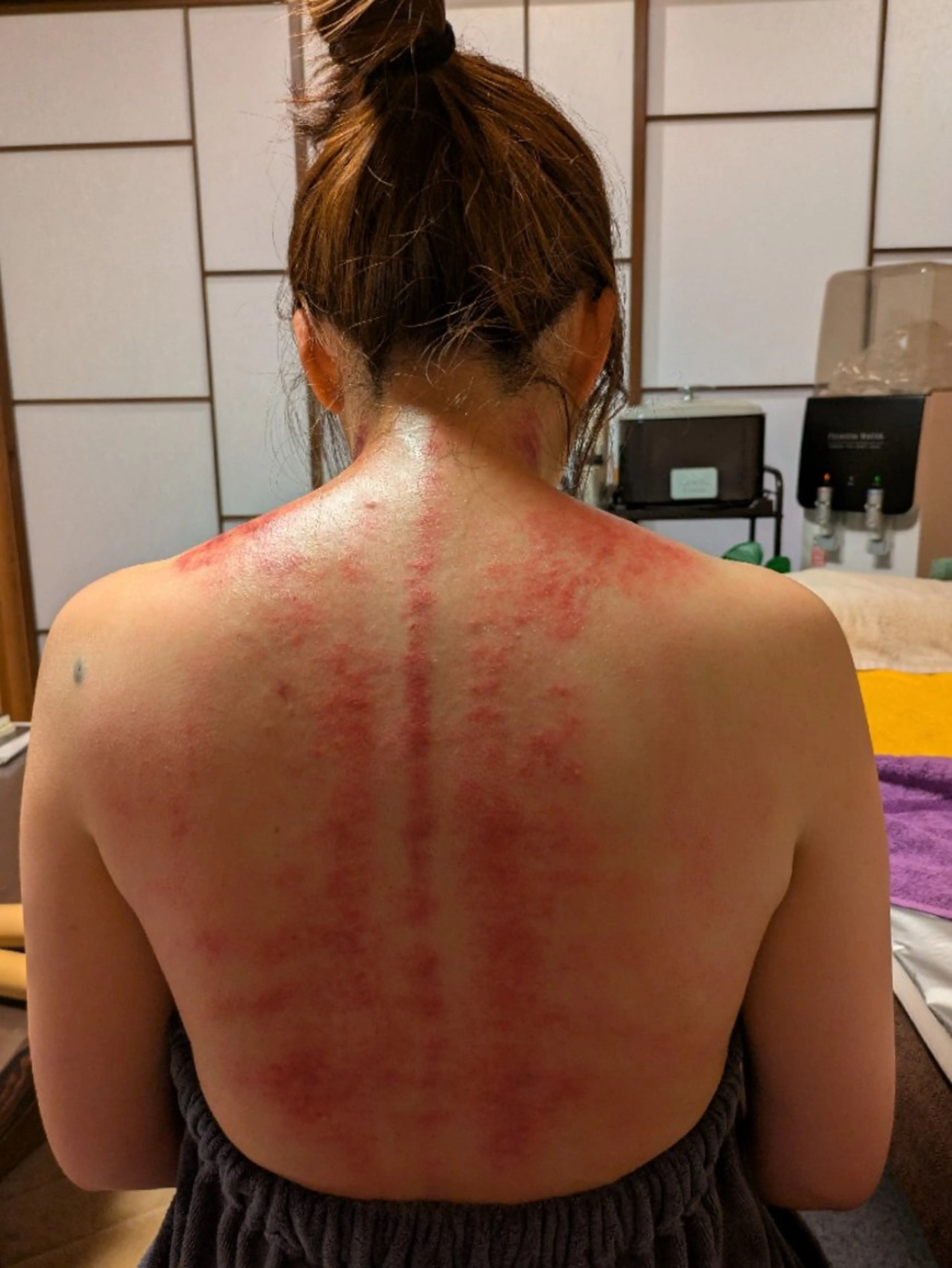 人気！ダイエットメニュー（カッサ→黄土モリンガ蒸し→足湯デトックス人気の３つのメニューを受けれます）の写真