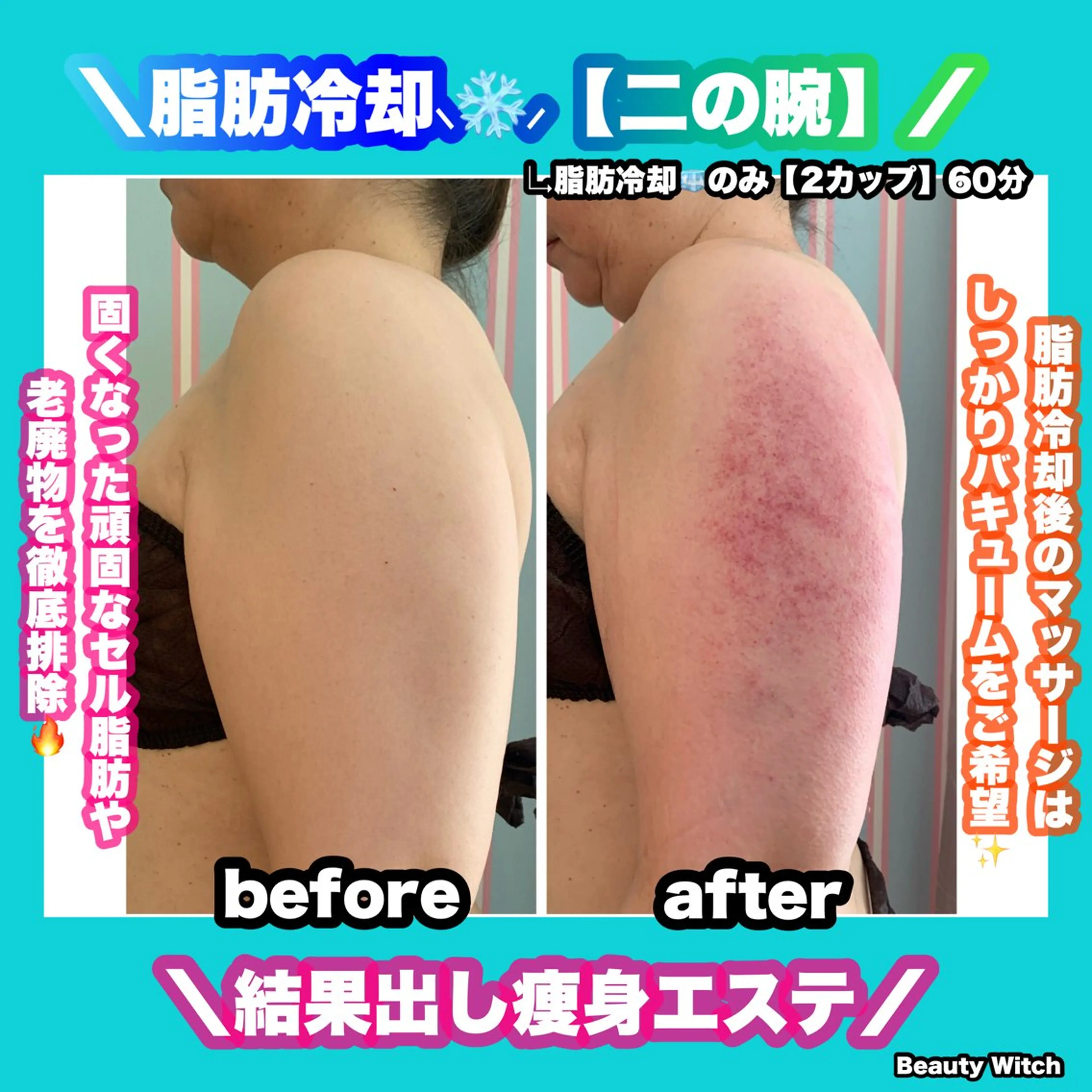 エステ リラク 痩身/脱毛/ネイル HARUKAのエステ・リラクイメージ