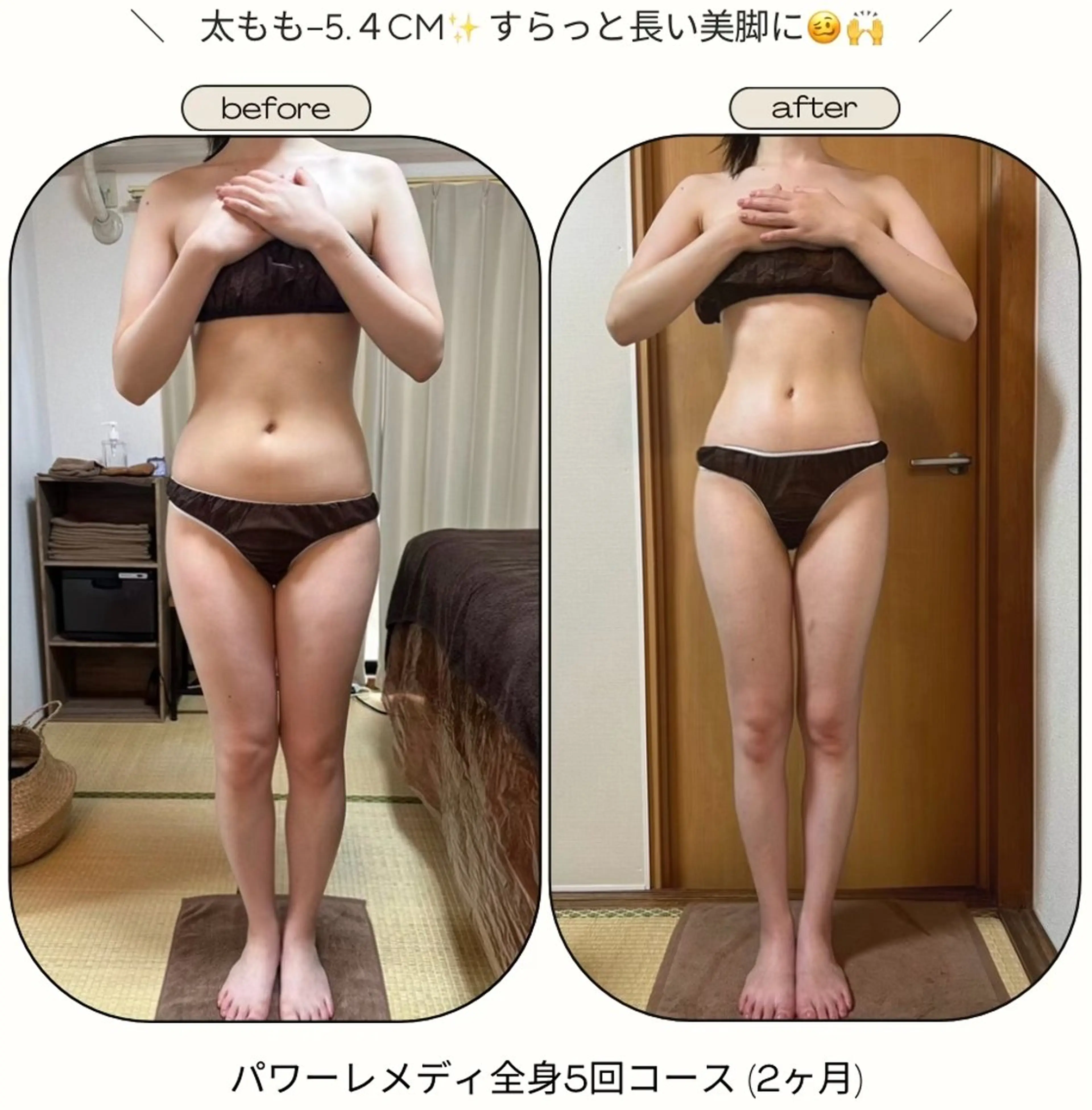 《本気痩せ×疲労改善 》  BILOOPのエステ・リラクイメージ