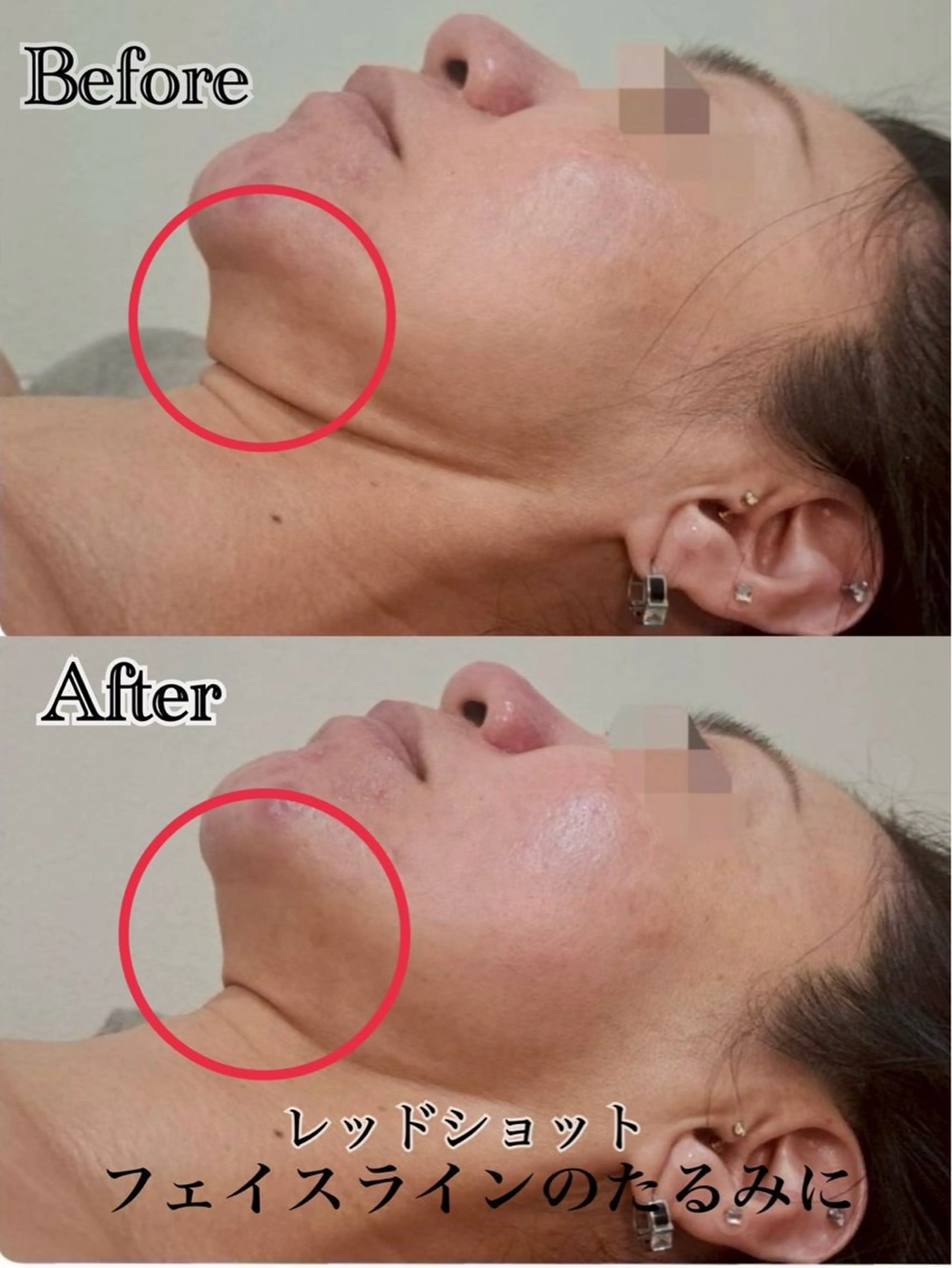 六本木脱毛andS さおりのエステ・リラクイメージ