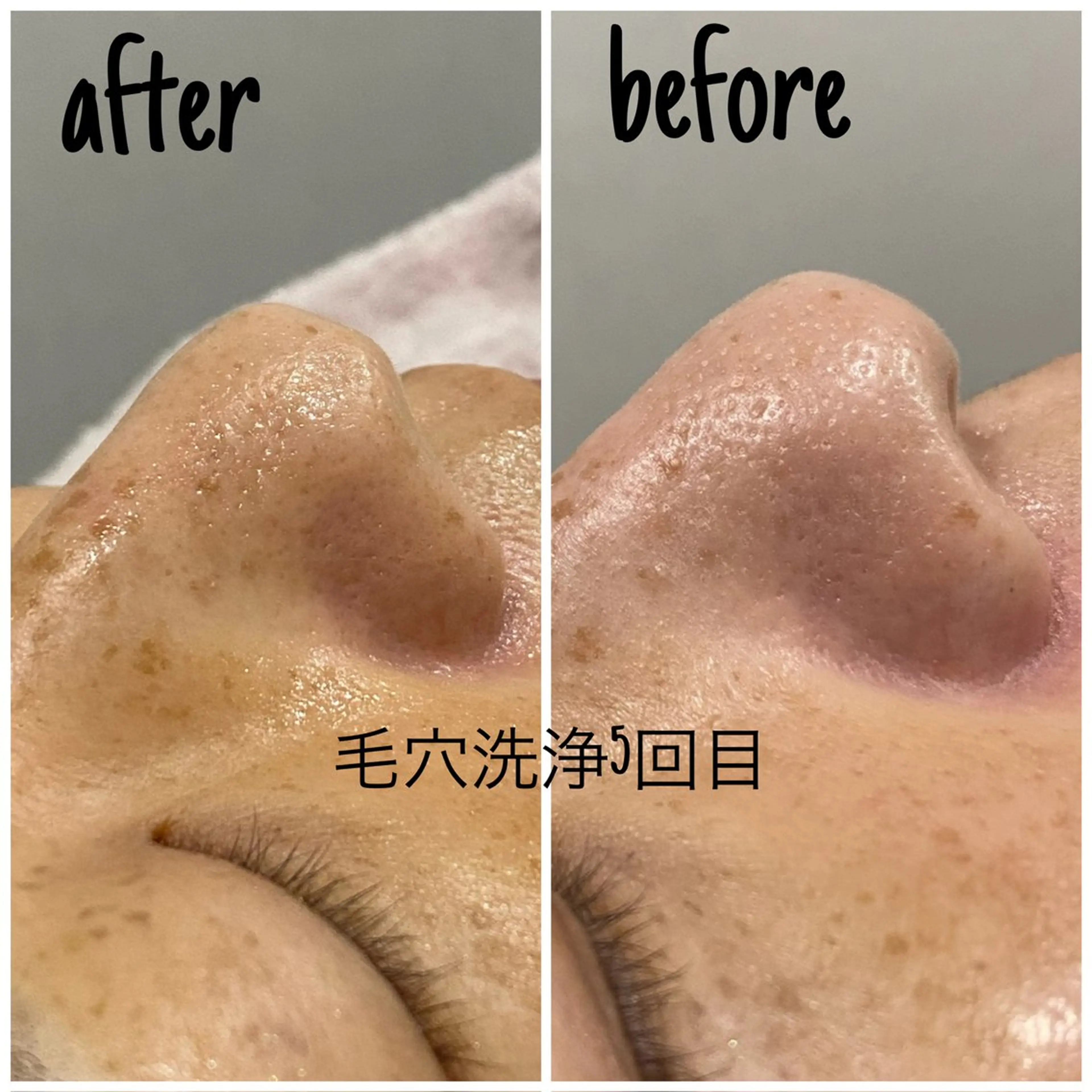 エステ 毛穴洗浄・痩身・脱毛 /アルカンジュのエステ・リラクイメージ