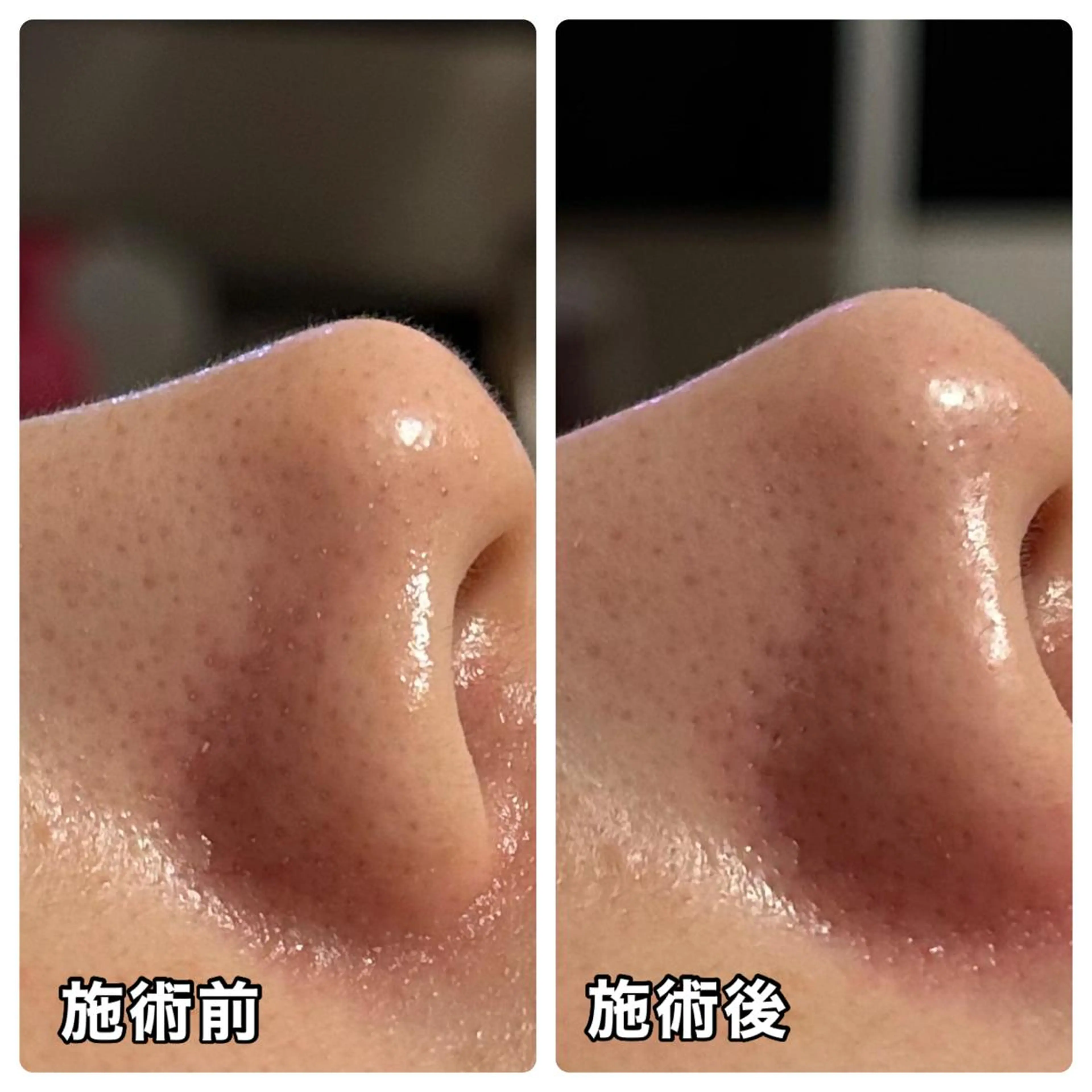 エステ リラク 🌴Beauty Salon LANAのエステ・リラクイメージ