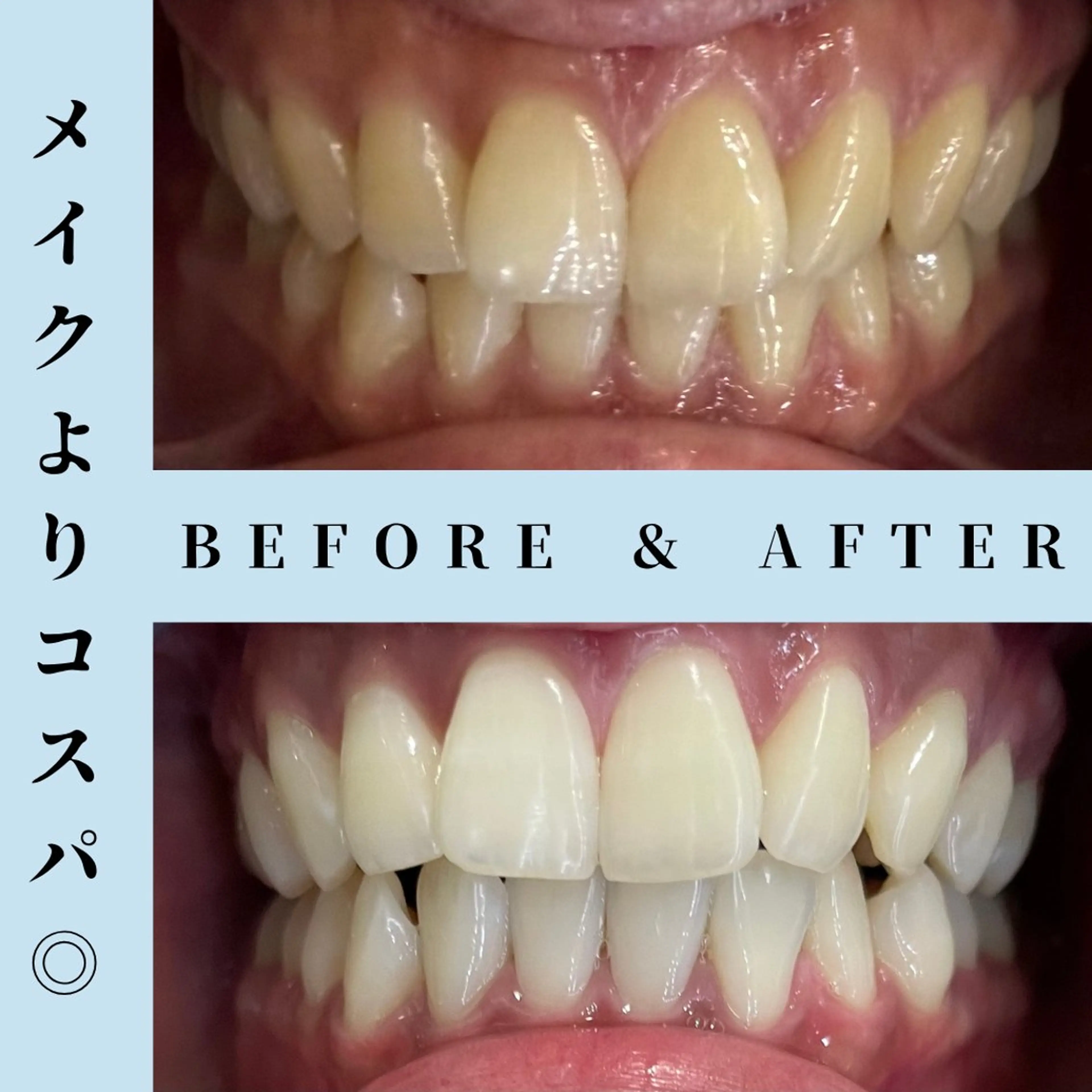 メンズ その他 セルフホワイトニング Dolce水戸店のその他イメージ