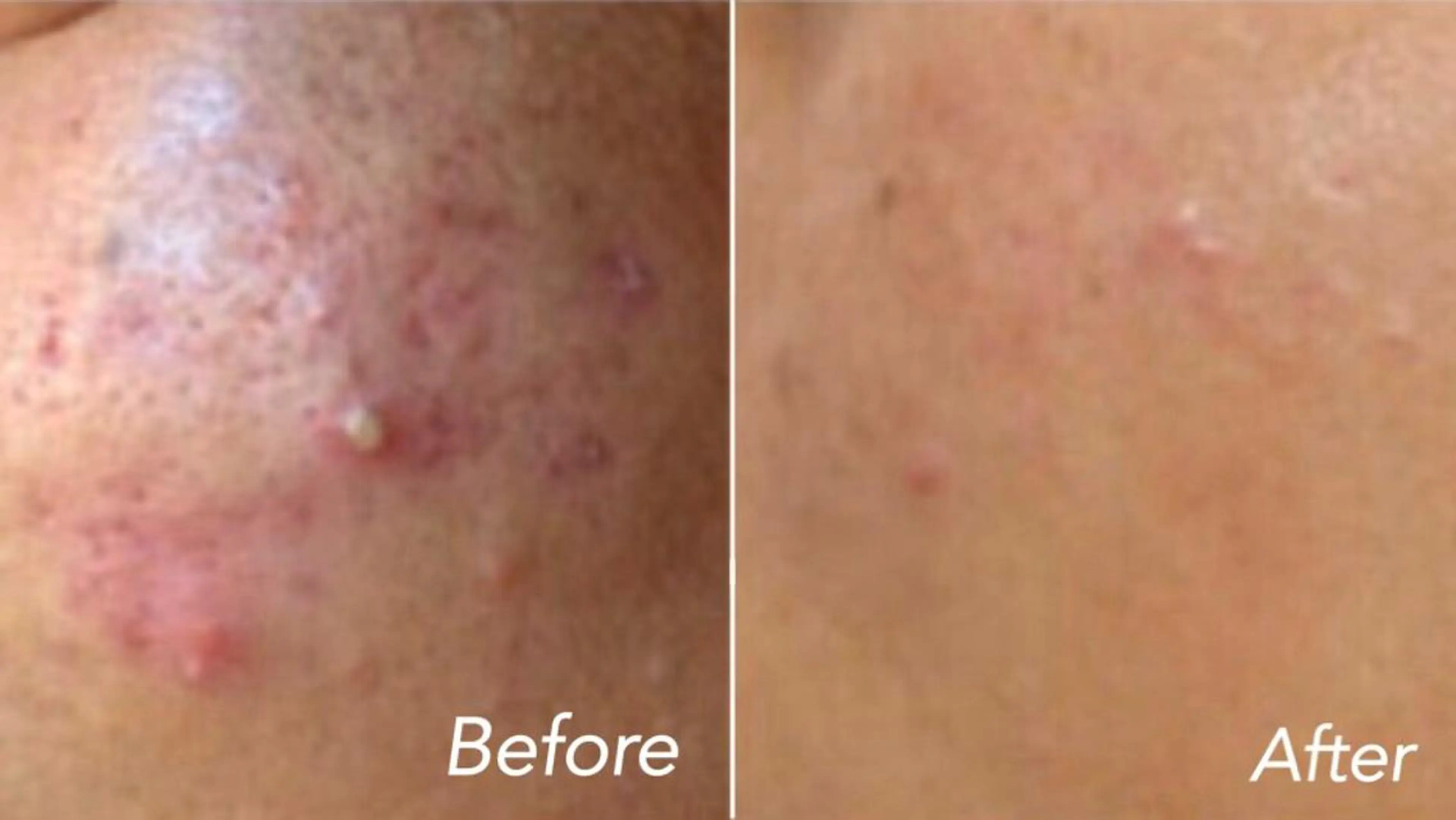 L’Beige レベージュのエステ・リラクイメージ