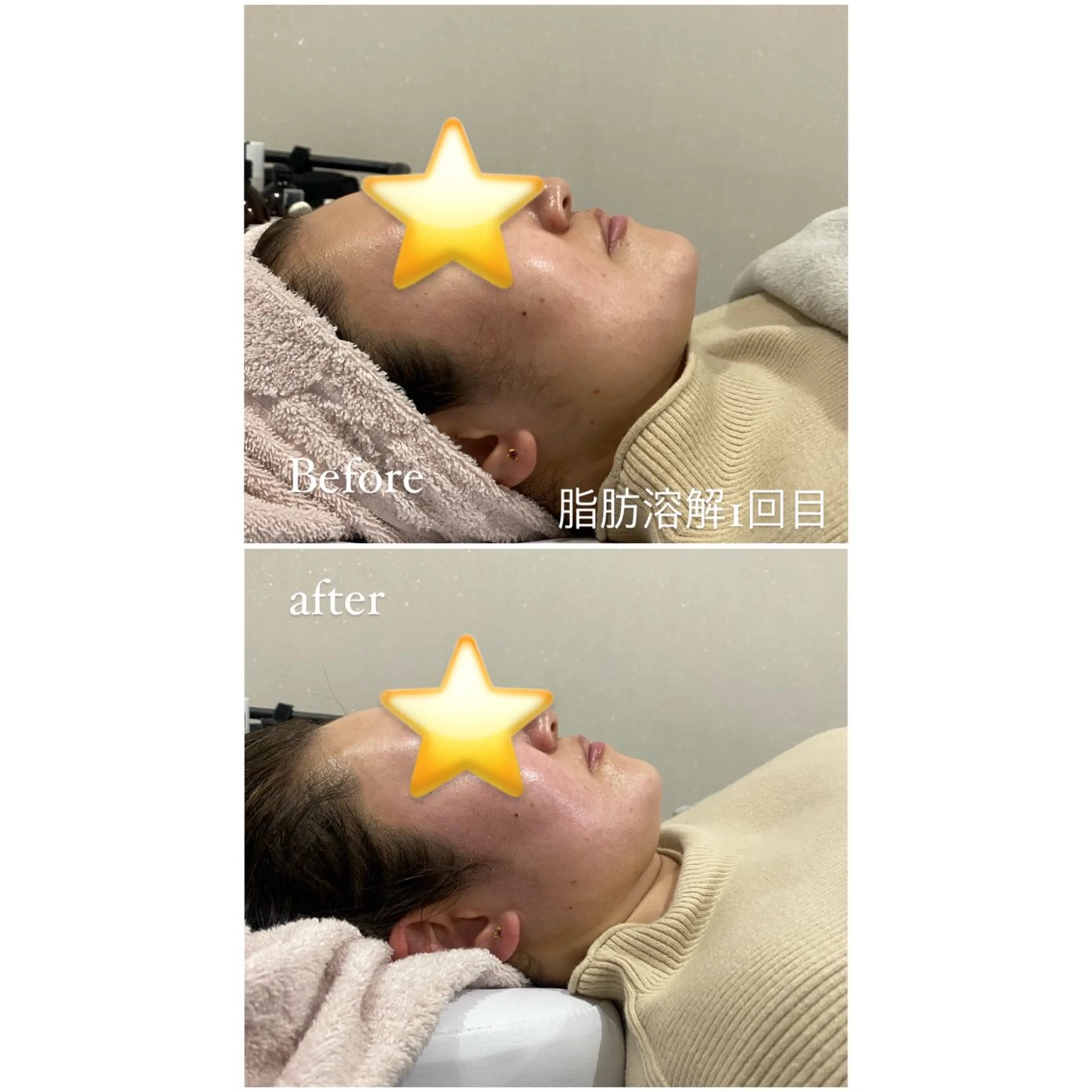 エステ 毛穴洗浄・痩身・脱毛 /アルカンジュのエステ・リラクイメージ