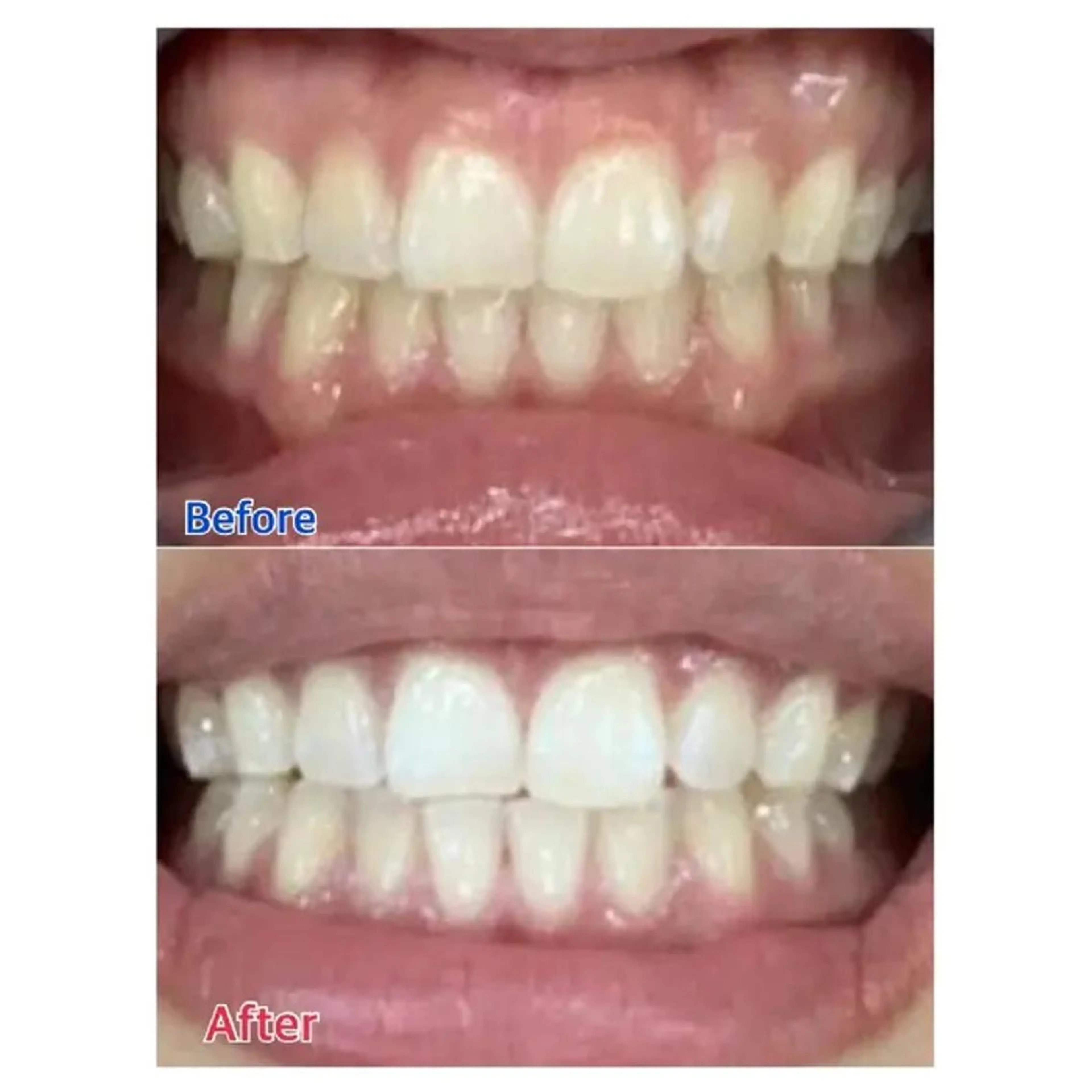 M渋谷 ホワイトニングのエステ・リラクイメージ