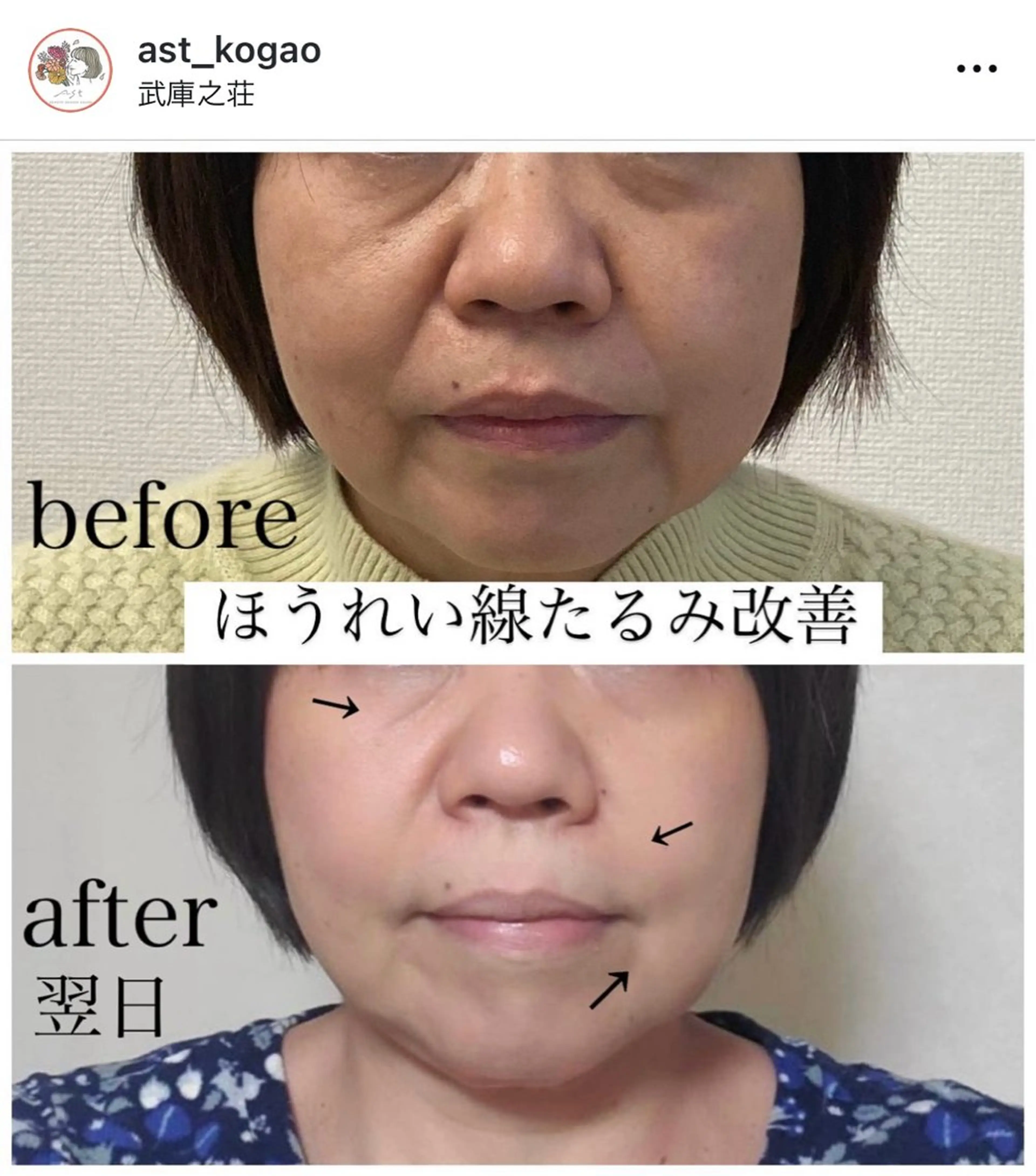 その他 小顔矯正サロン AST【アスト】のその他イメージ