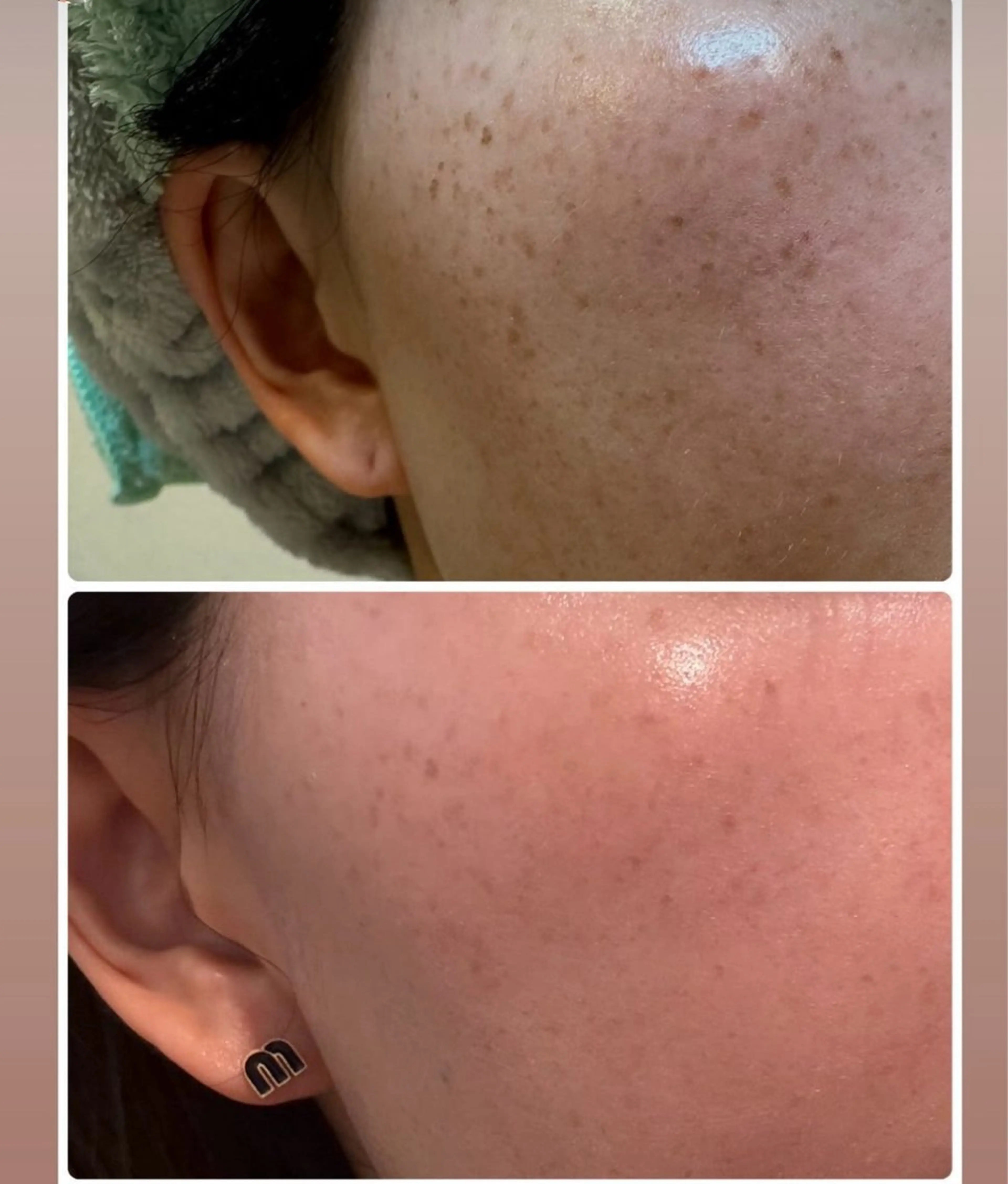 エステ Sena Dewi 🫧Ayakaのエステ・リラクイメージ