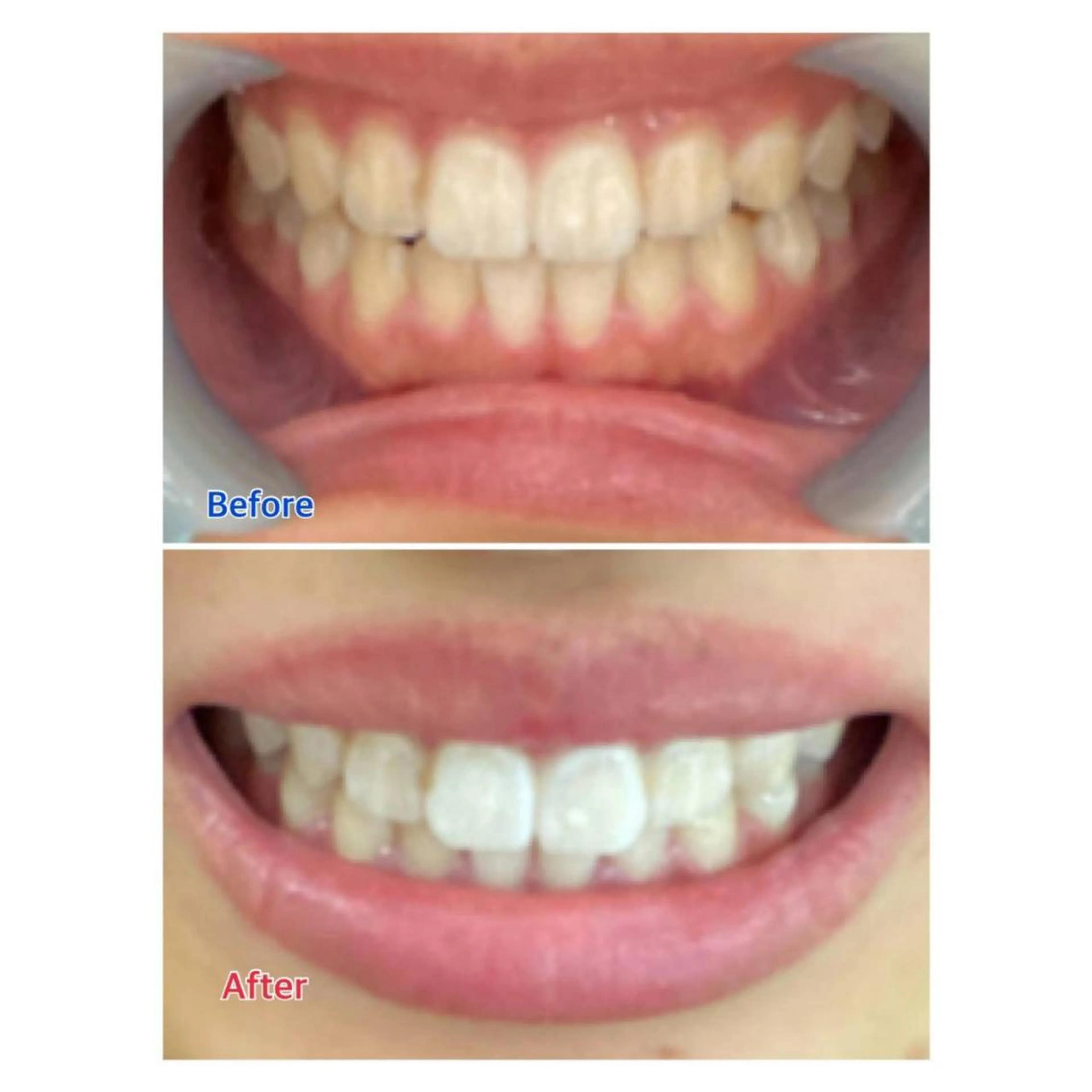 Melty 輝のその他イメージ