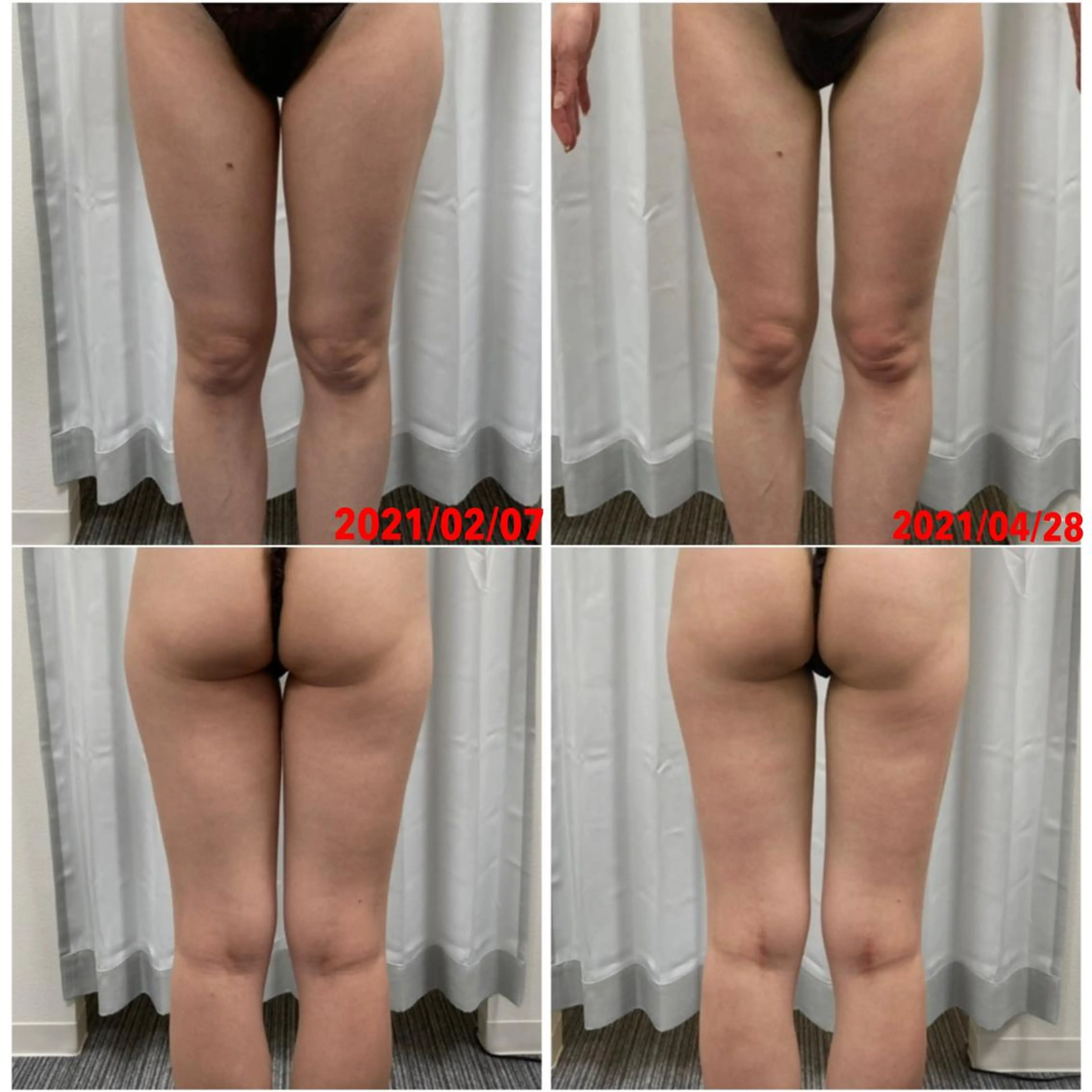 Linomalie エステ/たるみ/脱毛のエステ・リラクイメージ