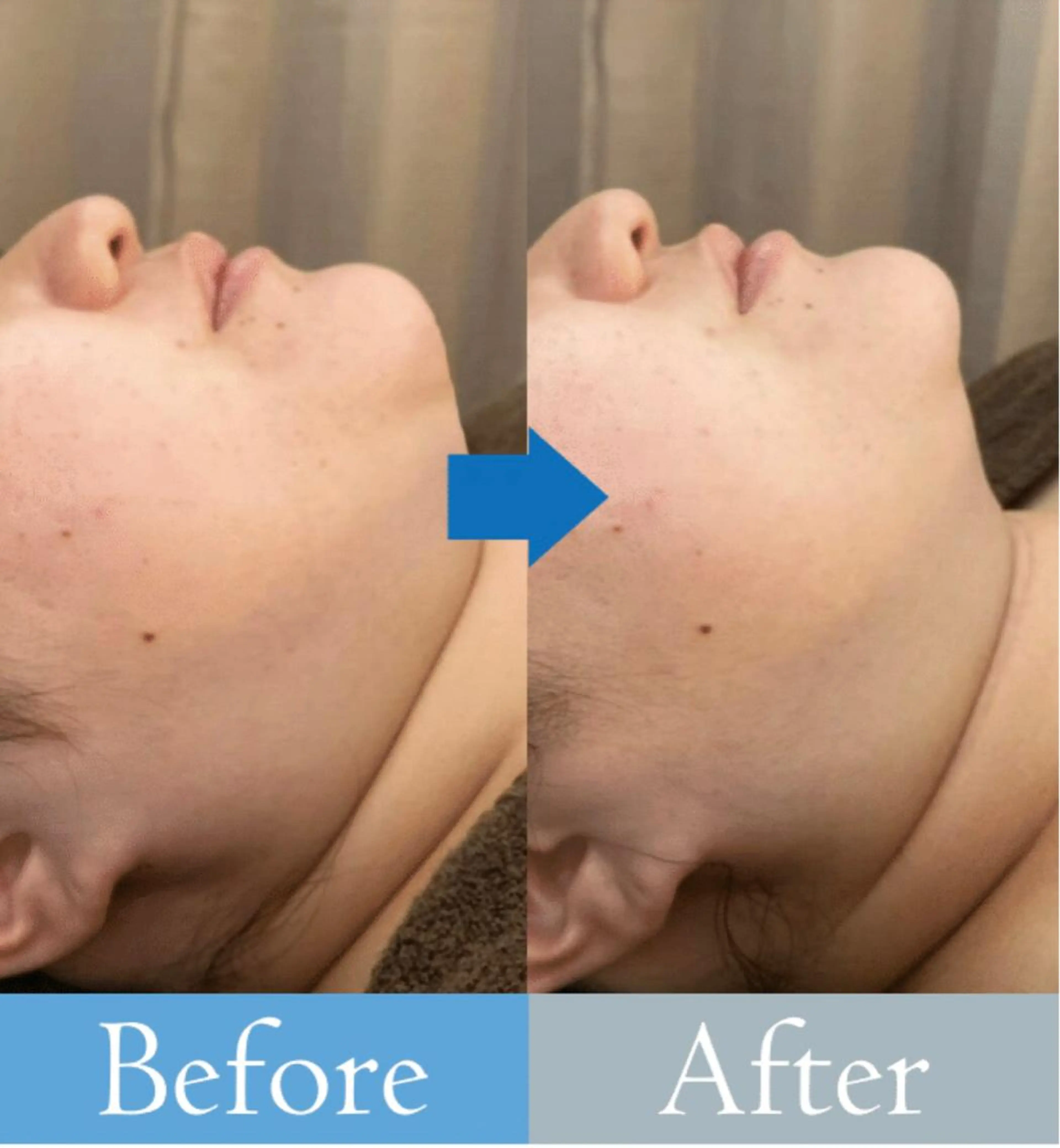 【医療提携エステ】 ルミナス北浦和のその他イメージ