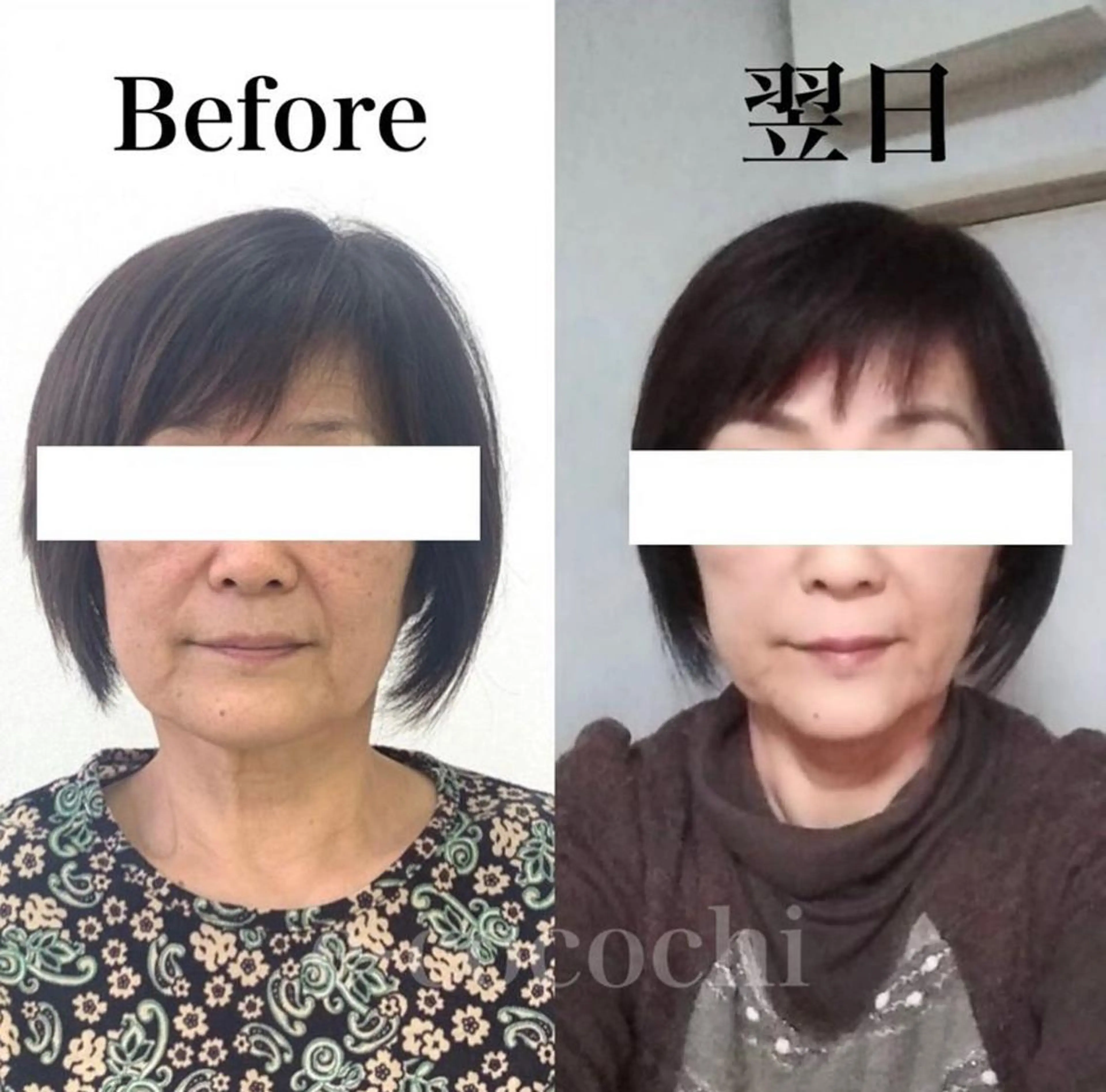 エステ リラク 小顔と ヘッドスパのお店のエステ・リラクイメージ