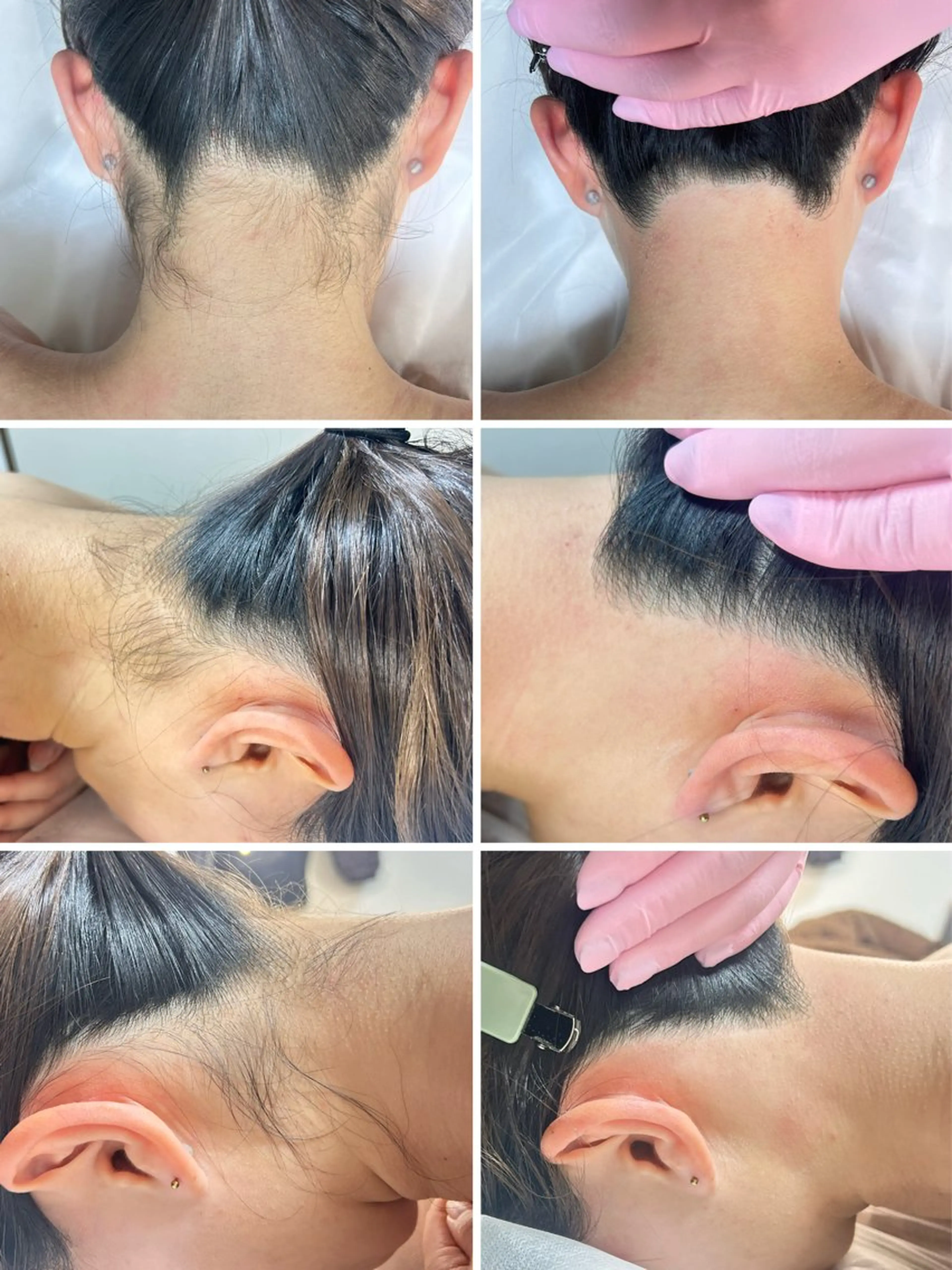 脱毛 STELLAR. 谷岡恵里香のエステ・リラクイメージ