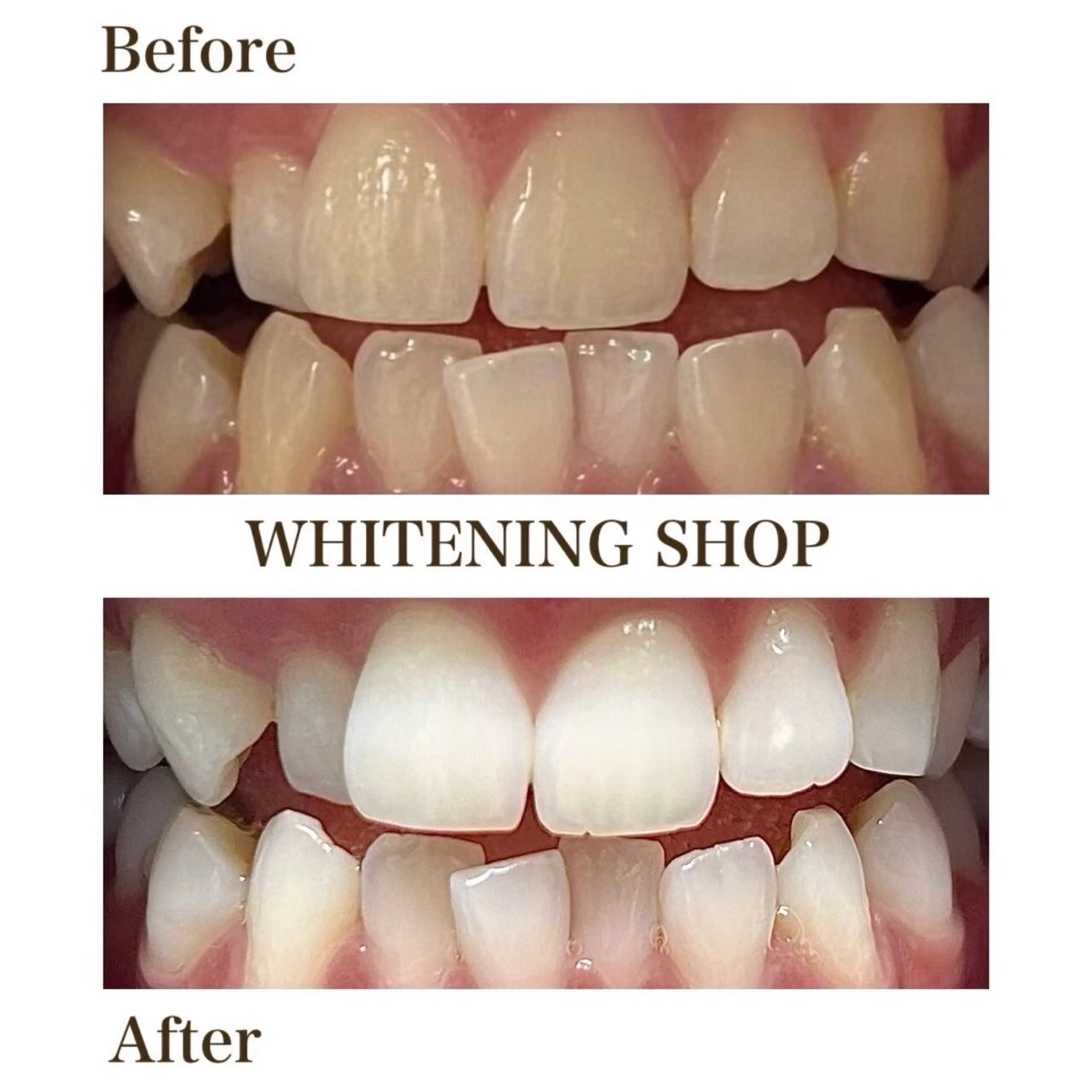 ホワイトニング ショップ川越店のエステ・リラクイメージ