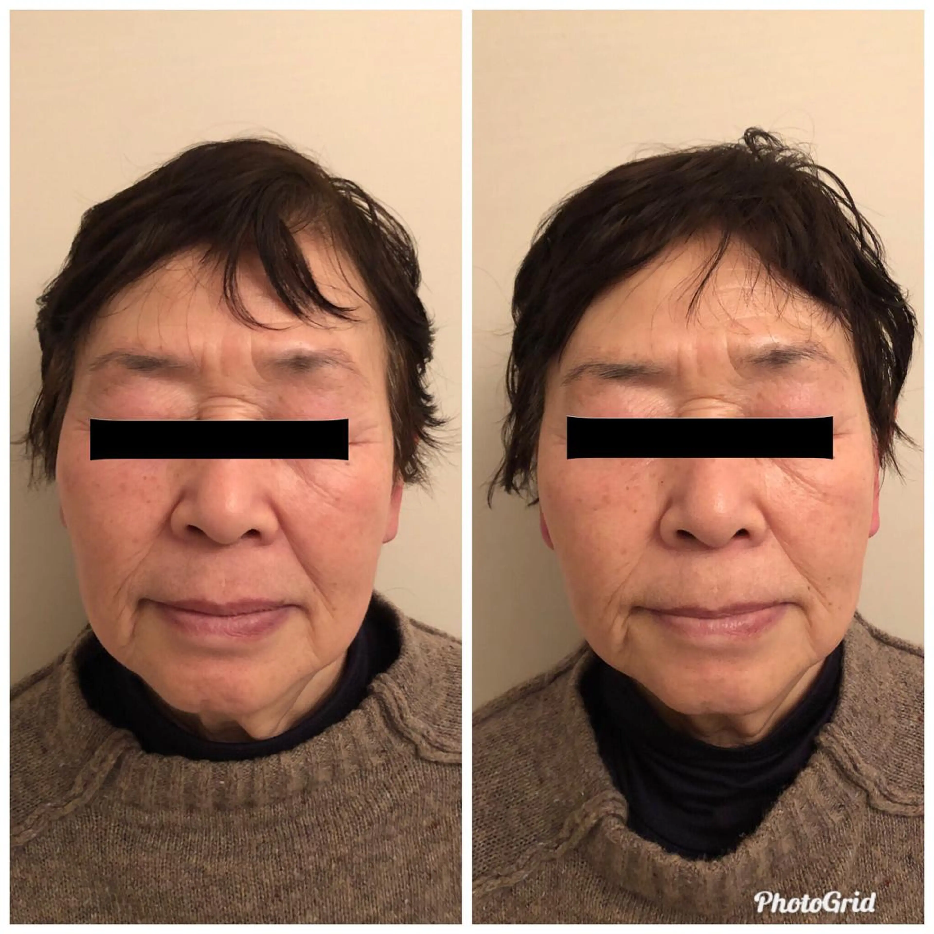 エステ リラク おうちサロン B-ROOMのエステ・リラクイメージ