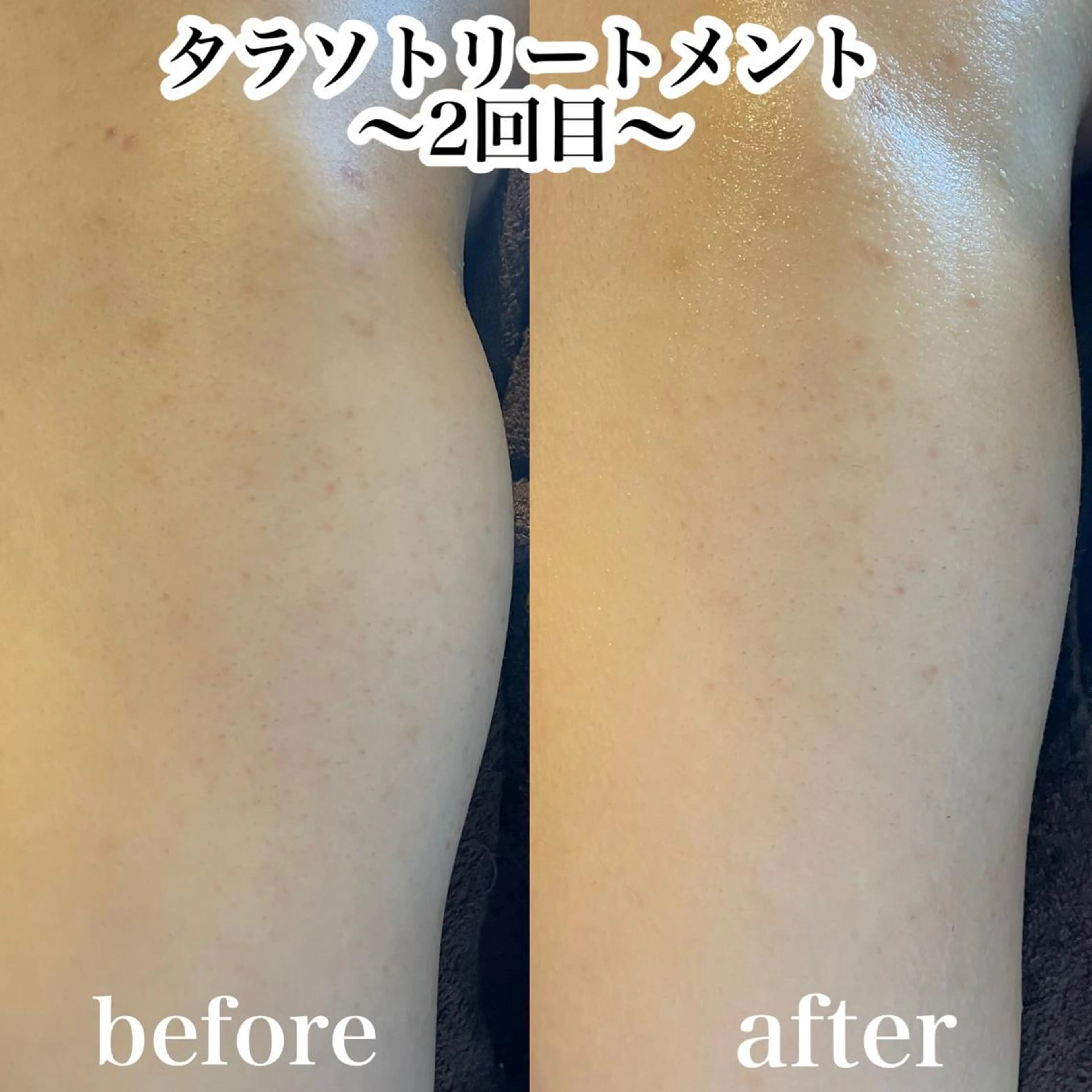 エステ 浜野 恵美のエステ・リラクイメージ