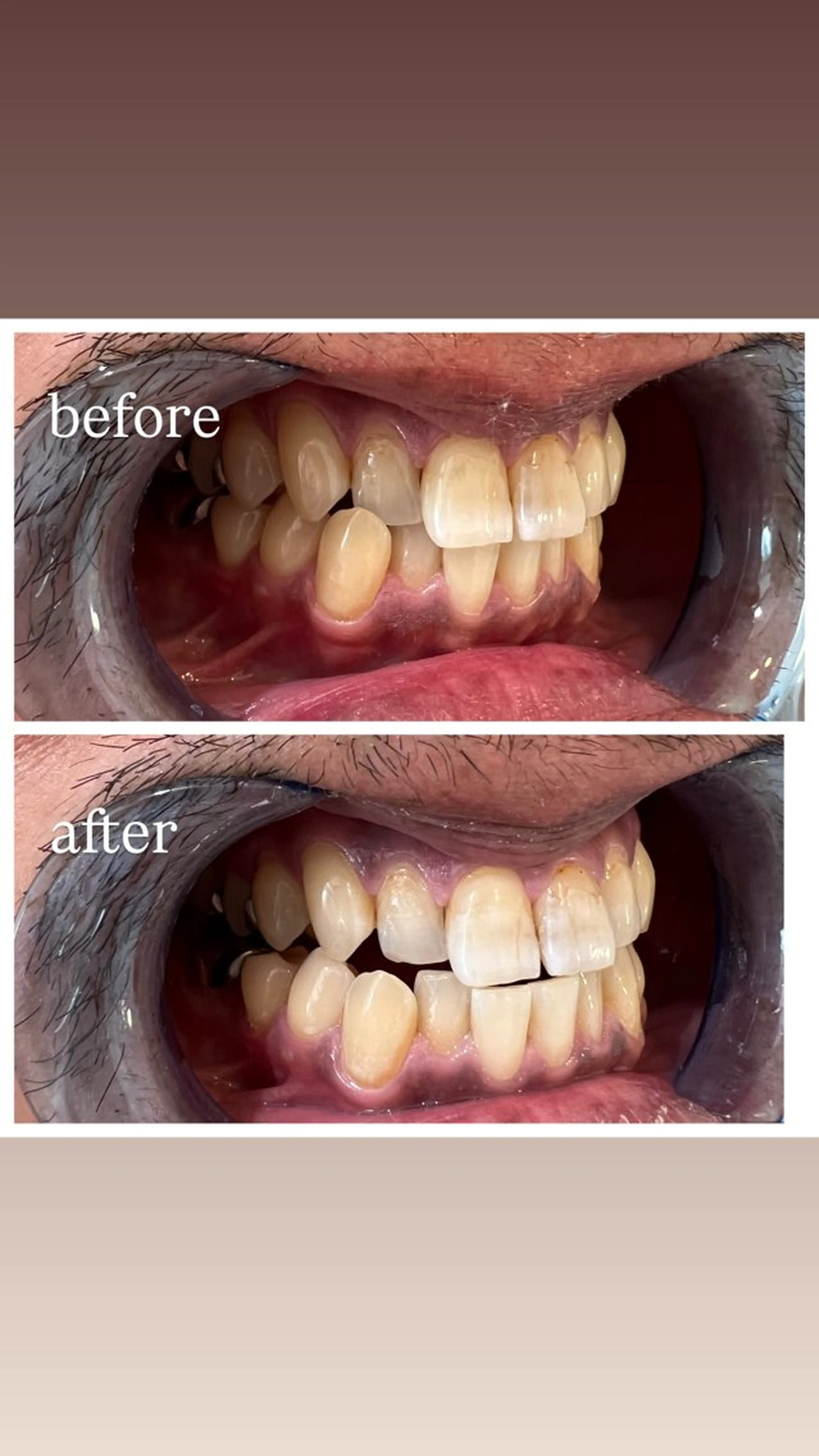 セルフホワイトニング Shineeのエステ・リラクイメージ