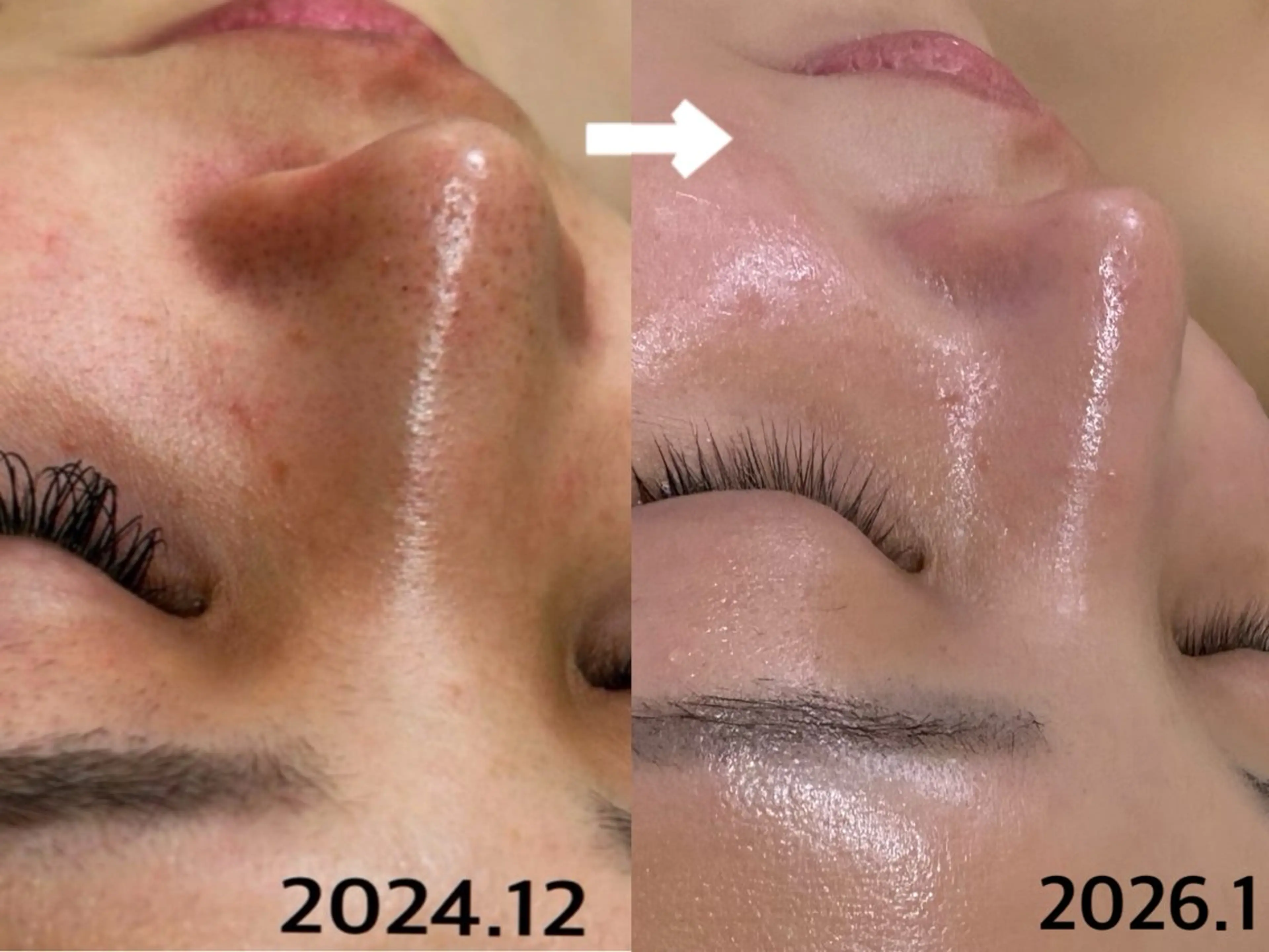 韓国艶美人// 毛穴ケア🌹のエステ・リラクイメージ