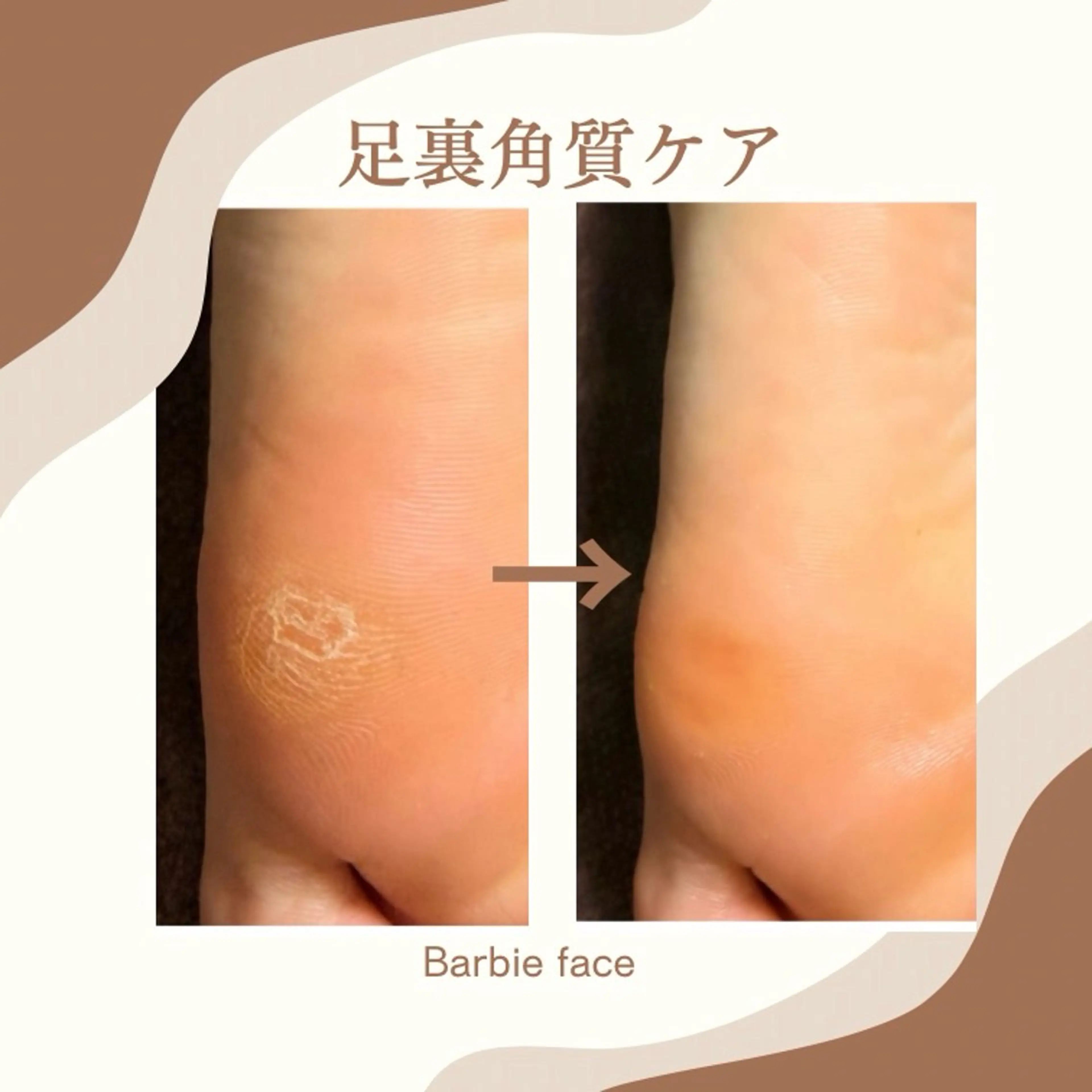 【新メニュー】ガサガサ足裏ケア！足裏から膝下までのマッサージ付きの写真