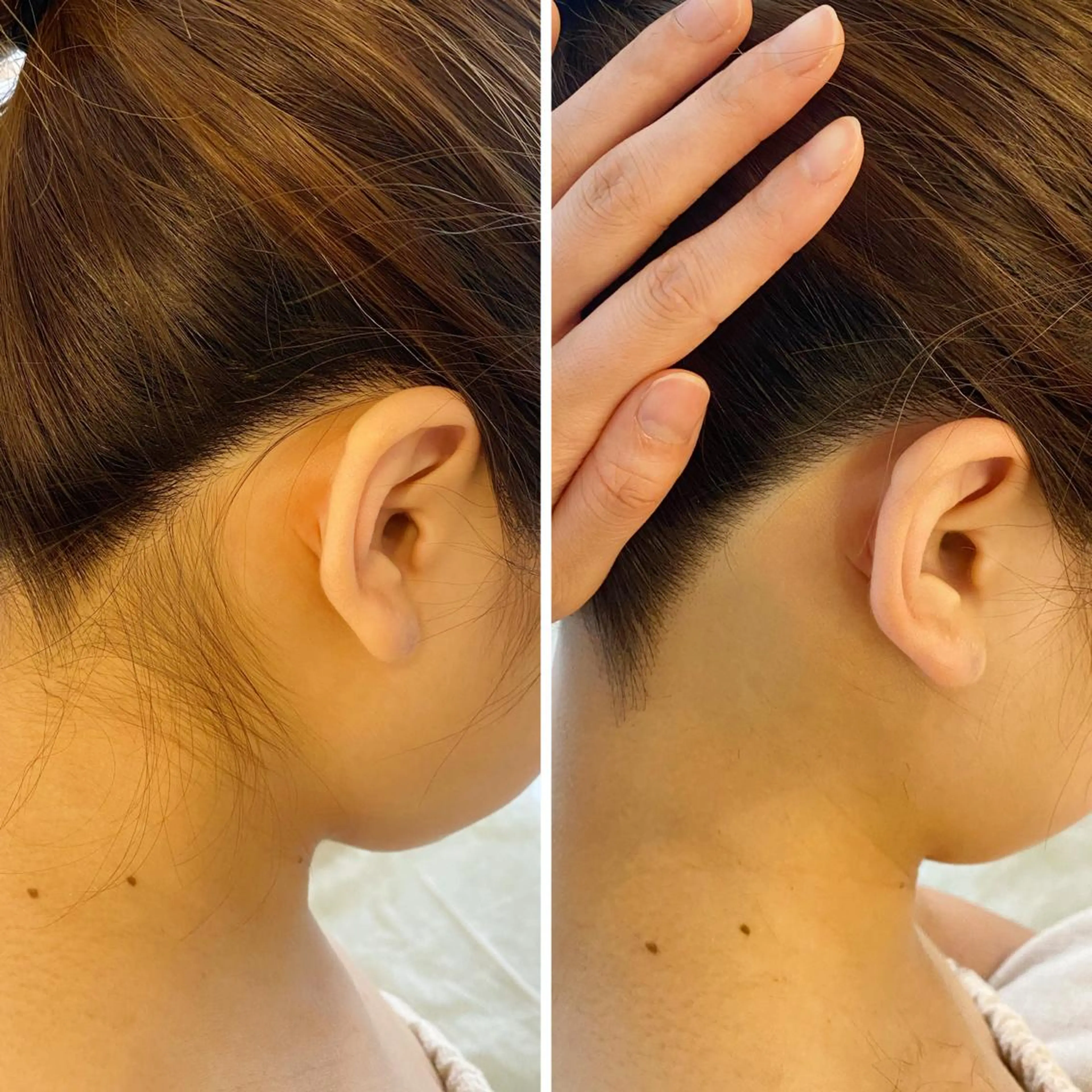 うなじ脱毛/美肌脱毛 LABELのエステ・リラクイメージ