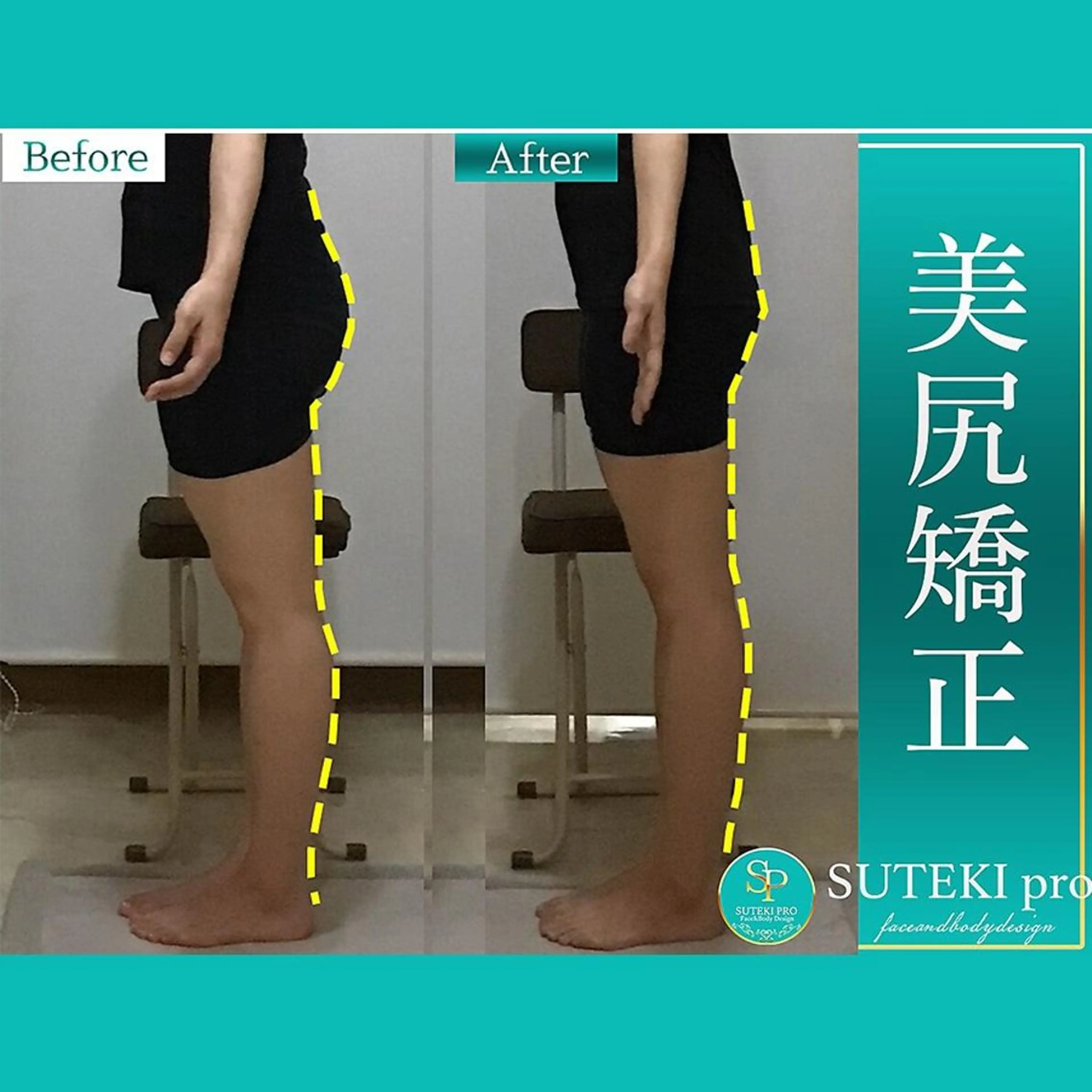 エステ リラク 姿勢・骨盤/小顔矯正 痩身ダイエット 横田のエステ・リラクイメージ