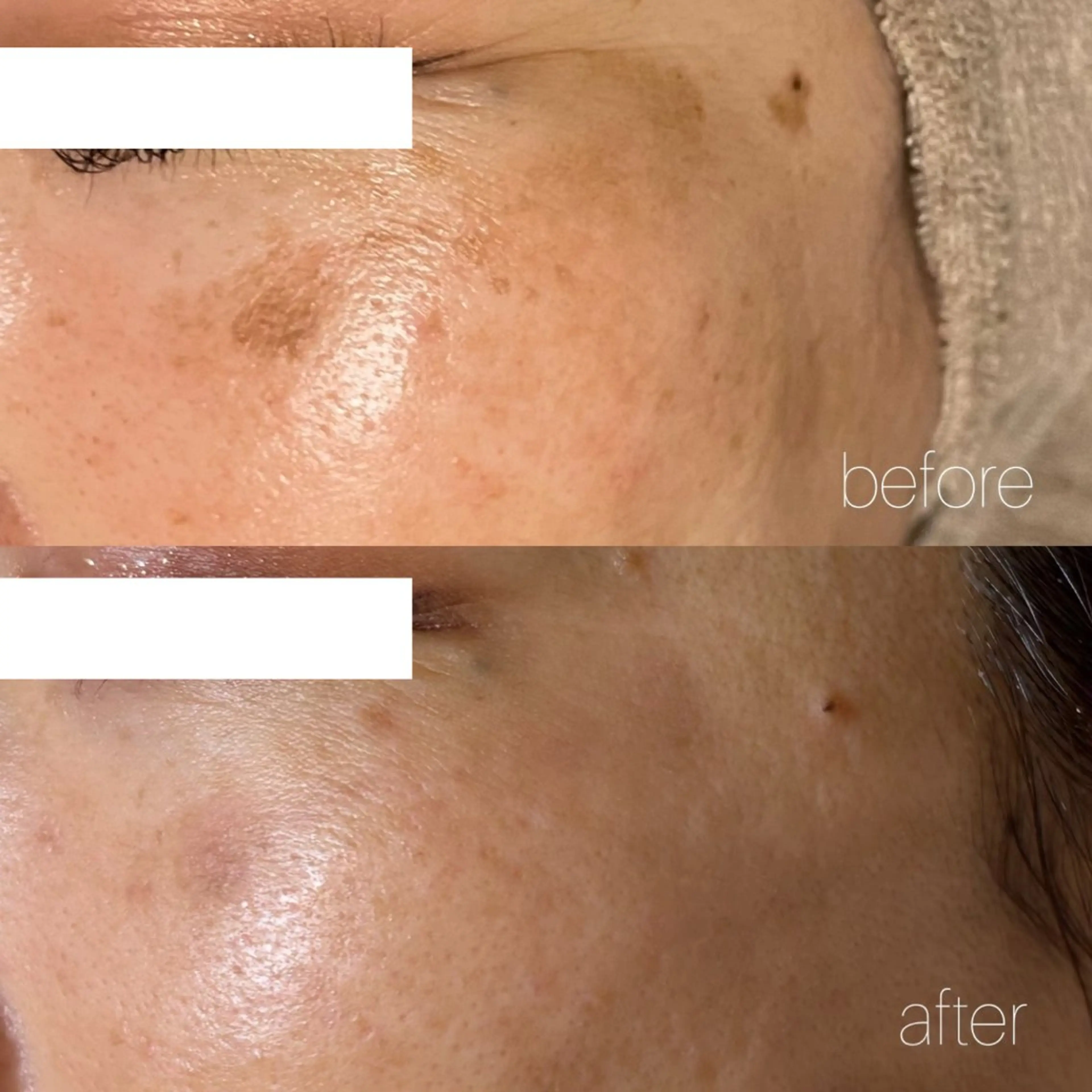 エステ Lassy Yuriの眉毛・アイブロウイメージ