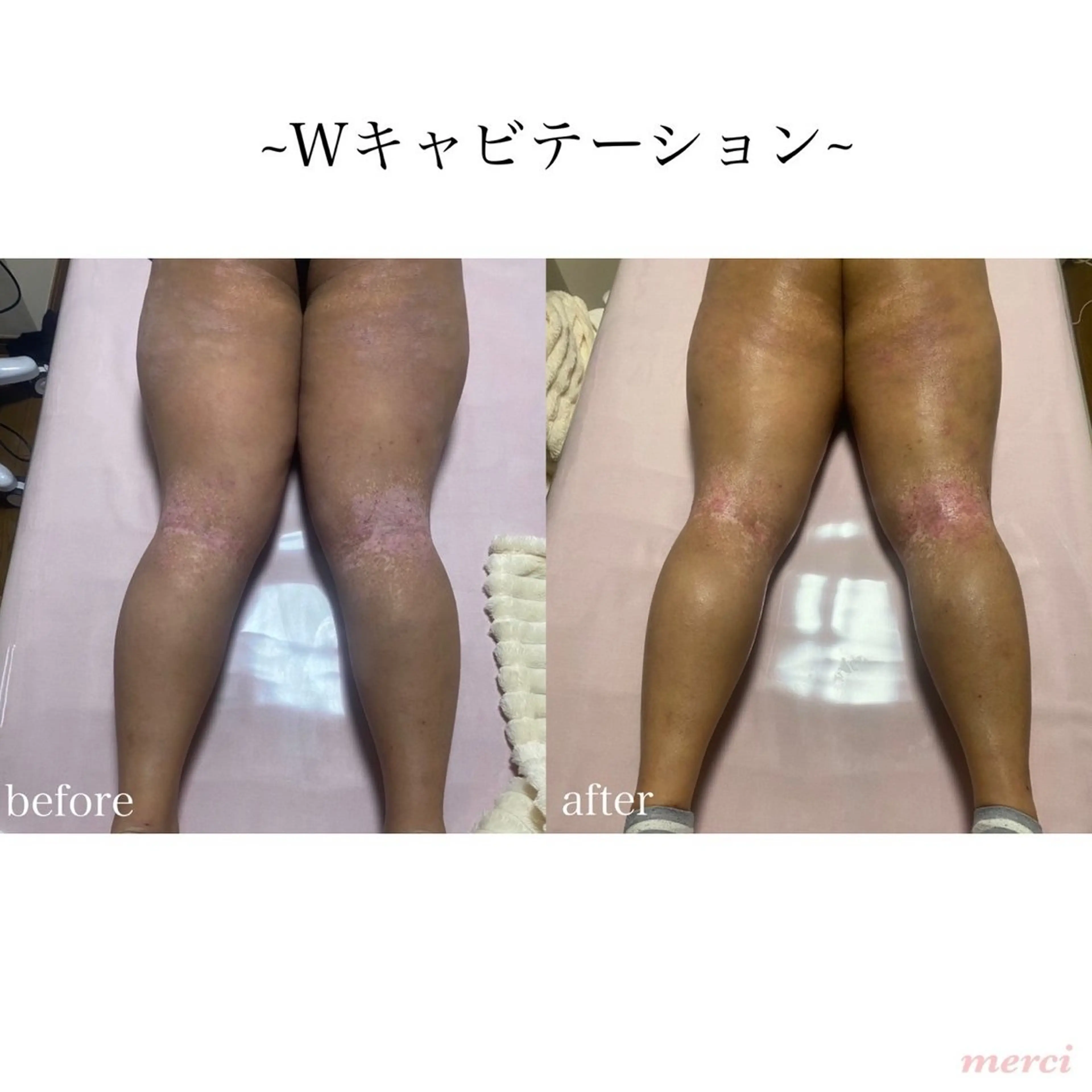 salon merci和泉のエステ・リラクイメージ