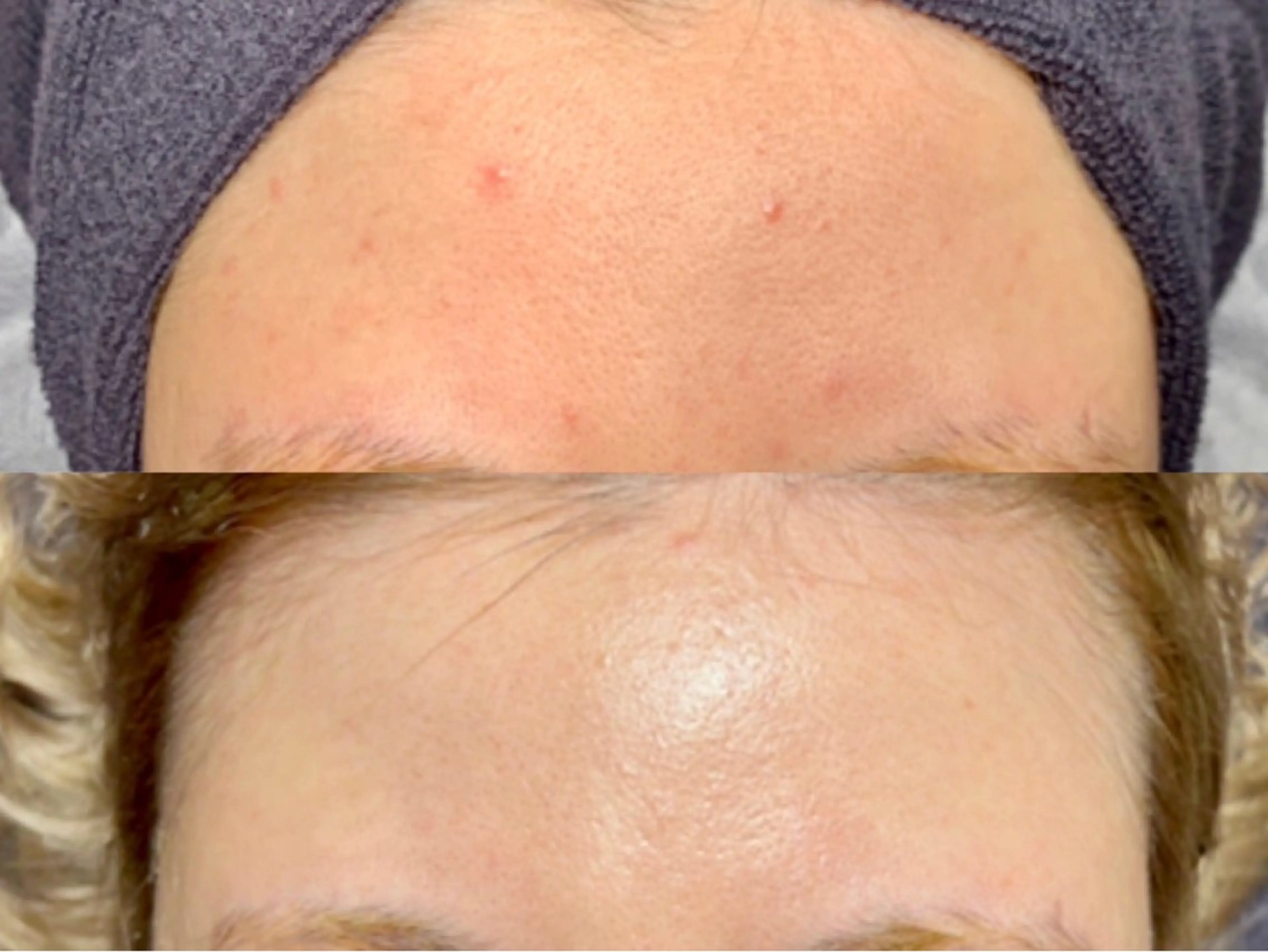 エステ ニキビ・毛穴・肌荒れ &me 西宮北口店のその他イメージ