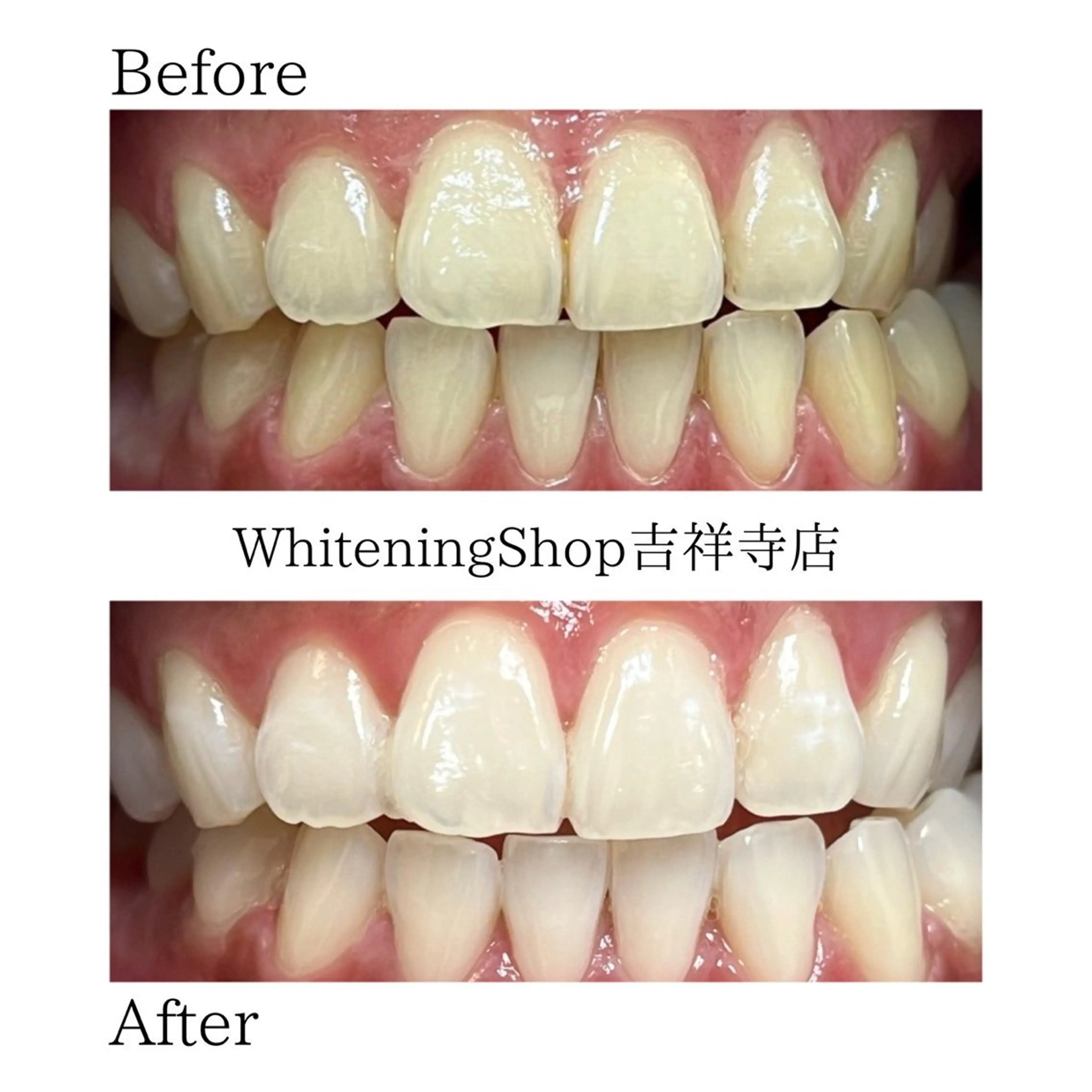 エステ リラク ホワイトニング ショップ吉祥寺店のエステ・リラクイメージ