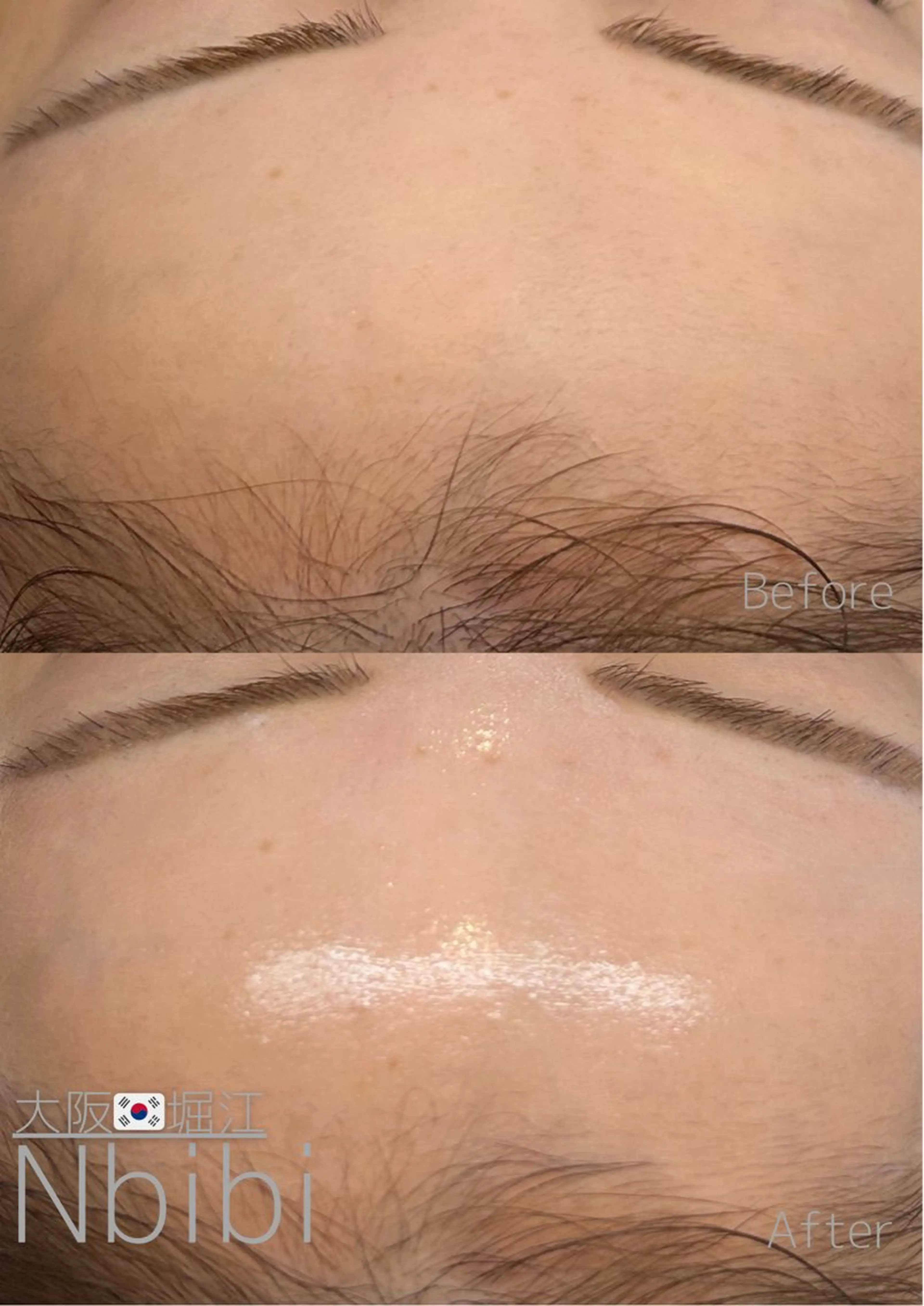 エステ 韓国🇰🇷価格 サロン_Nbibiの眉毛・アイブロウイメージ