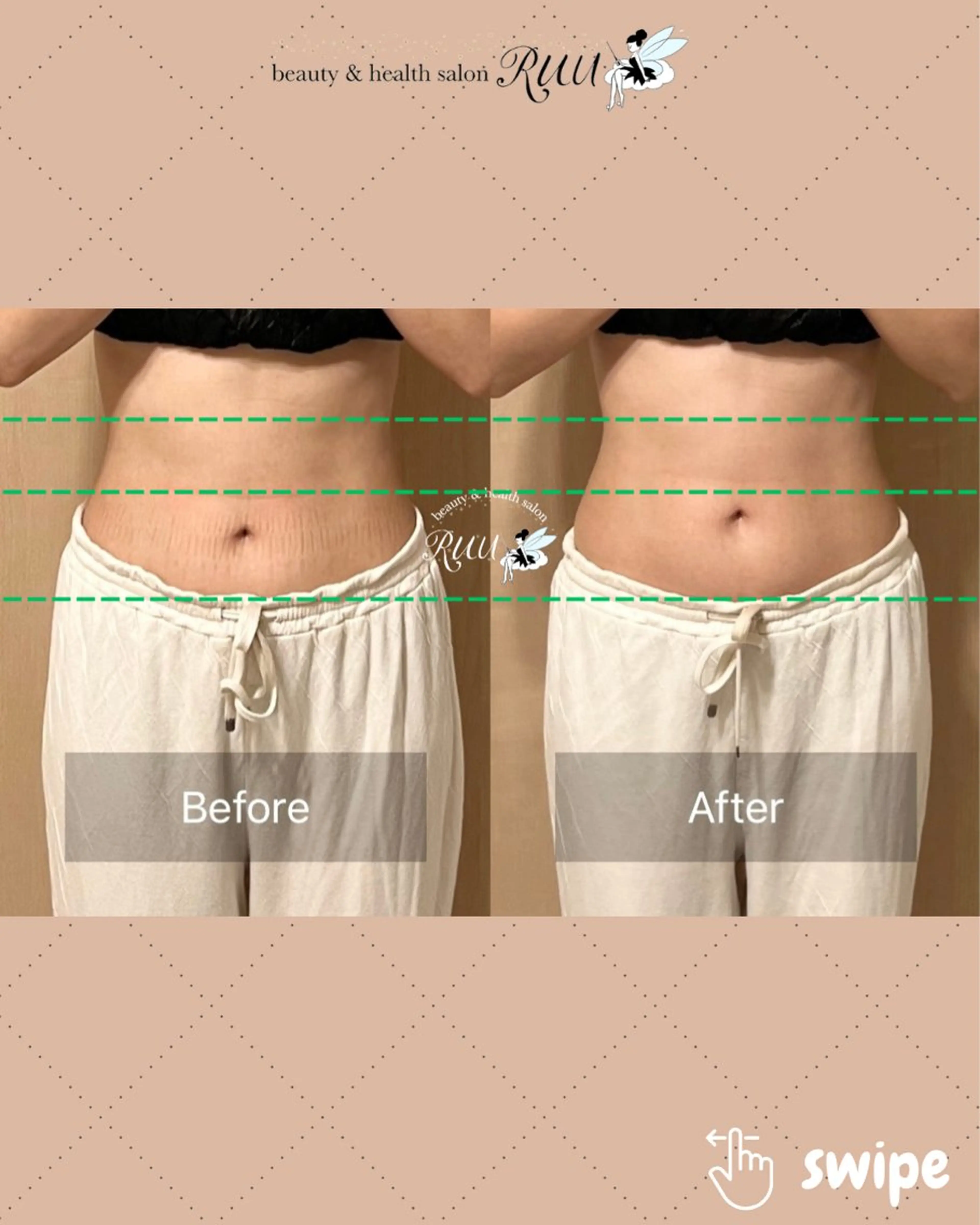 エステ リラク 【頭痛、睡眠改善】 salon RUUのエステ・リラクイメージ