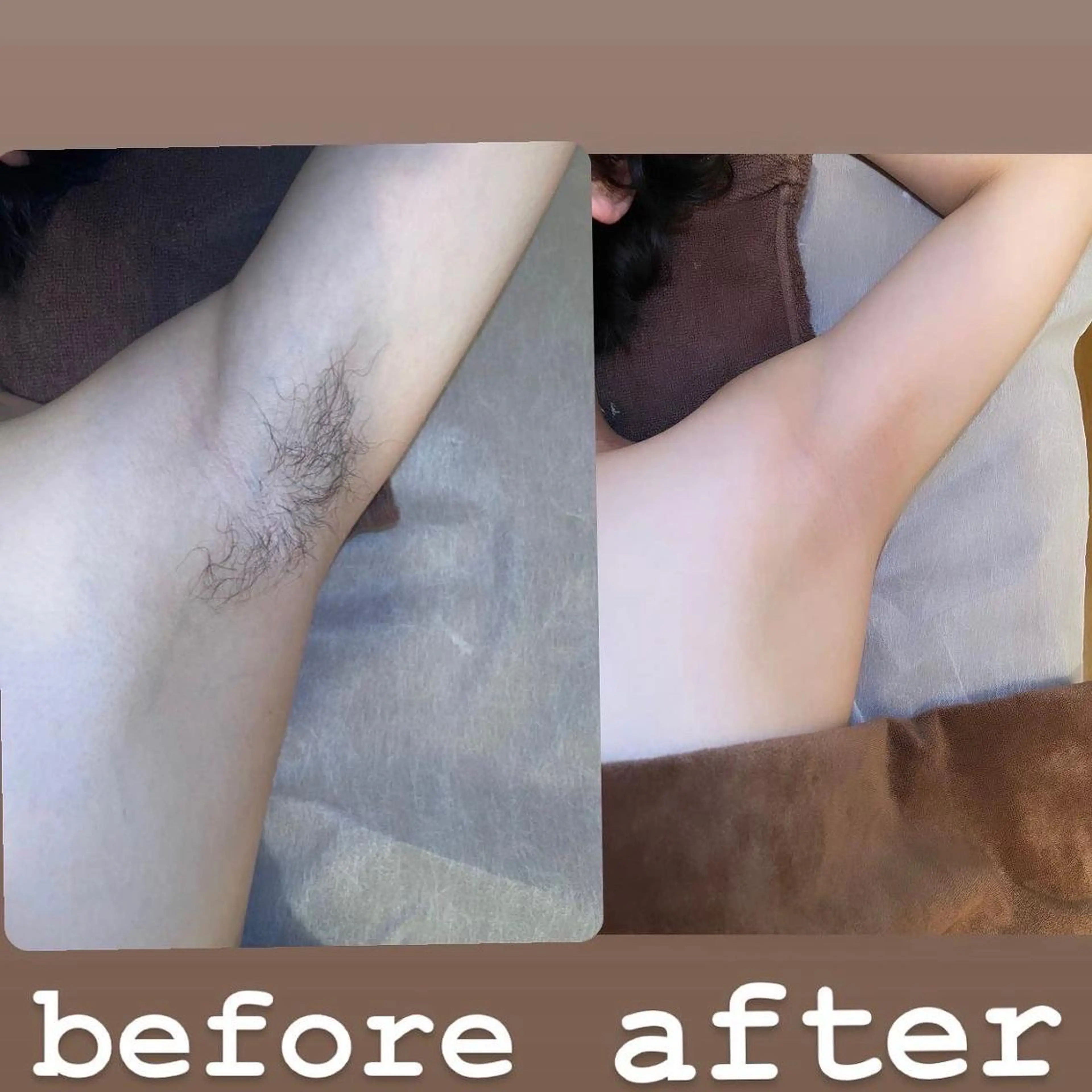 ◆[光脱毛]  脇　メンズ ワキ ¥3300✨の写真