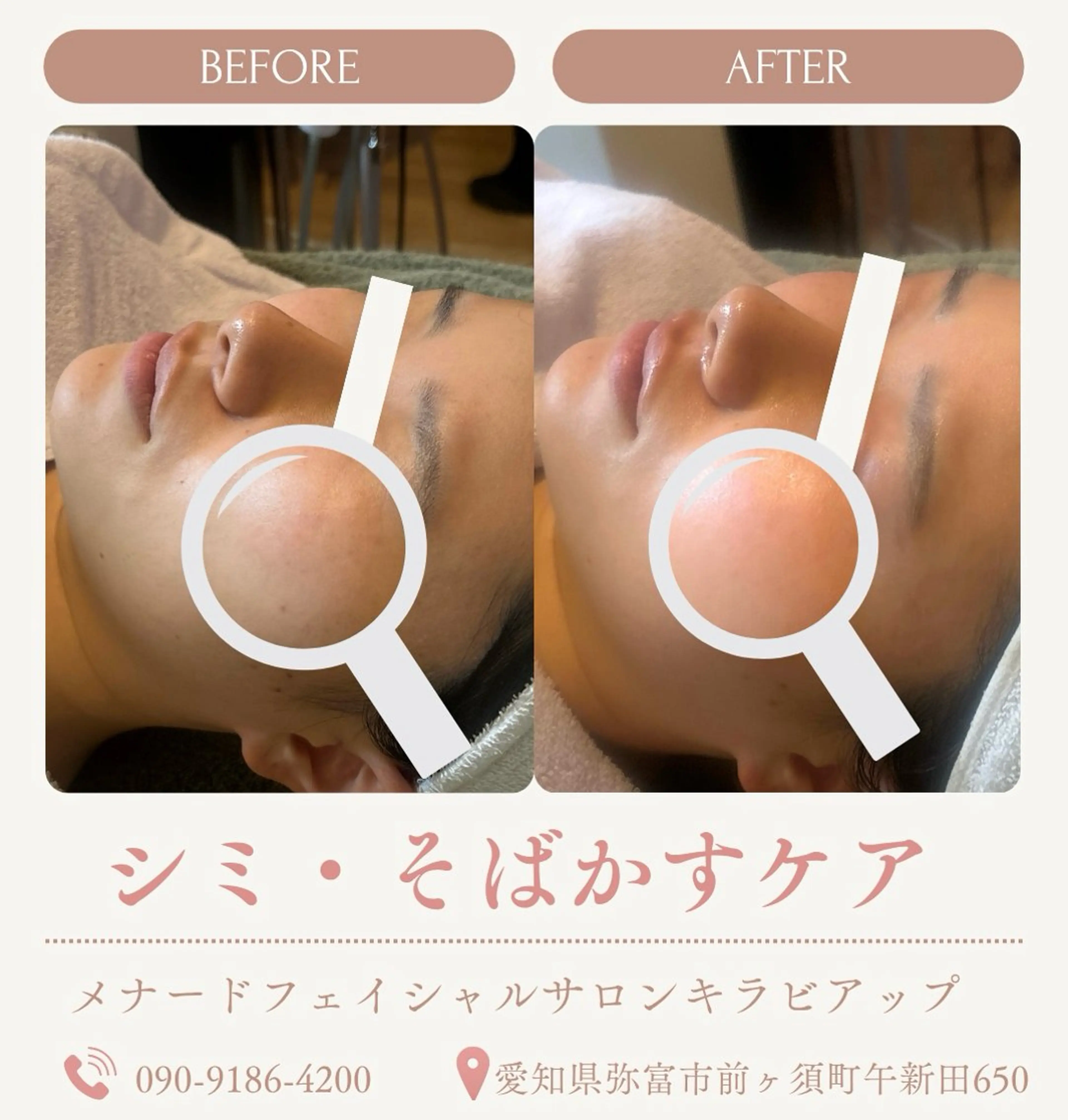 肌改善・美肌サポート 🤍tokoのエステ・リラクイメージ