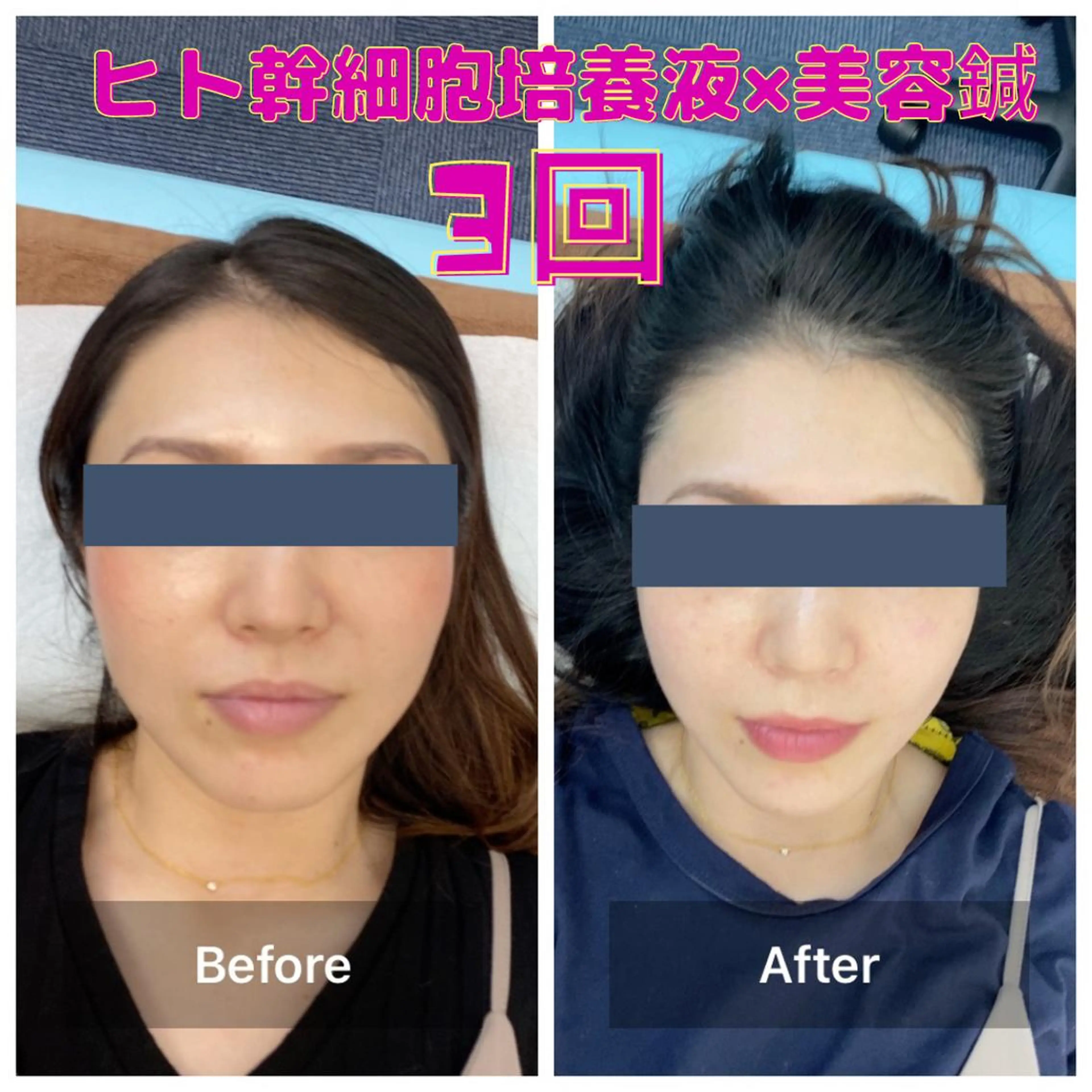 エステ gomi sayakaのエステ・リラクイメージ