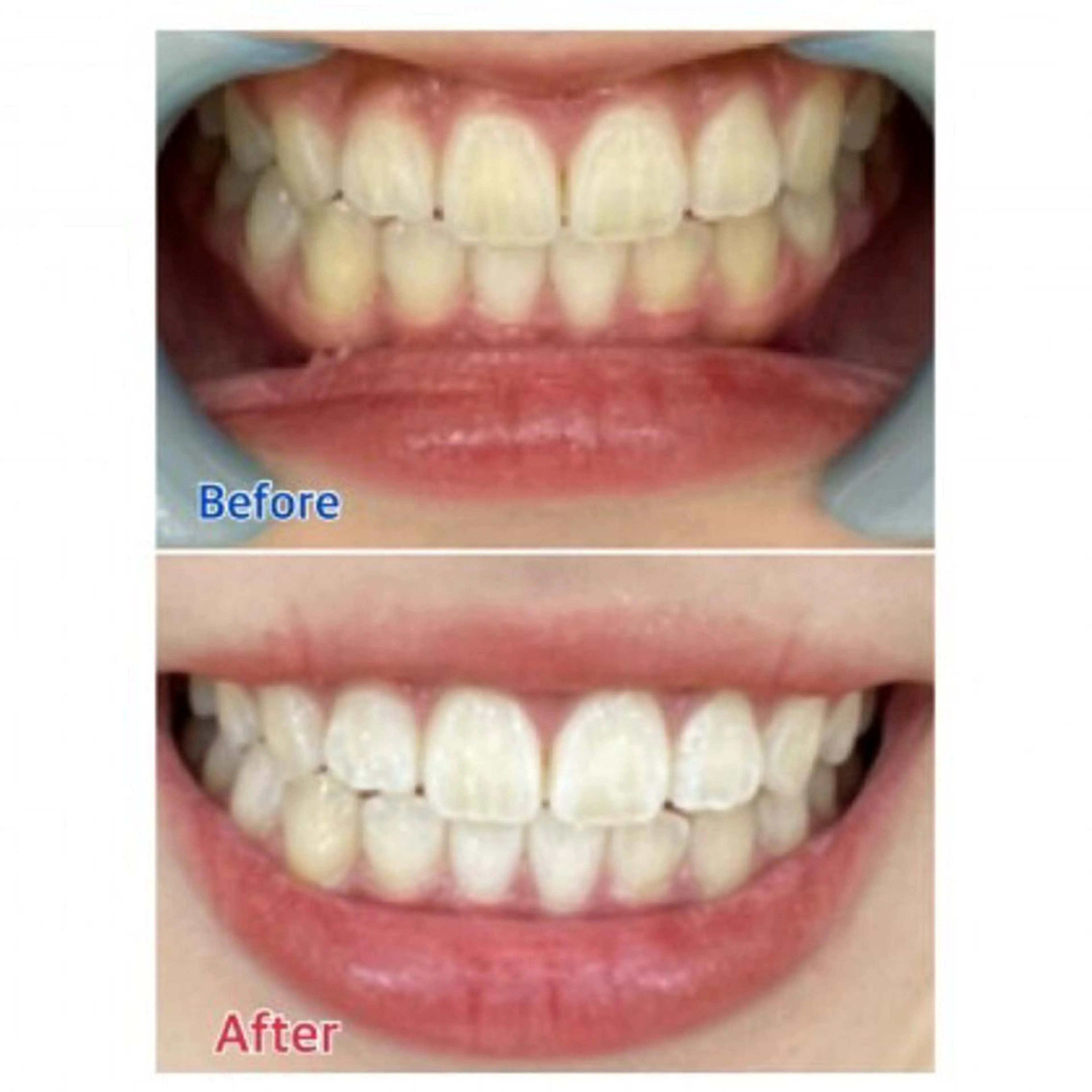 Ｍ渋谷 ホワイトニングのエステ・リラクイメージ