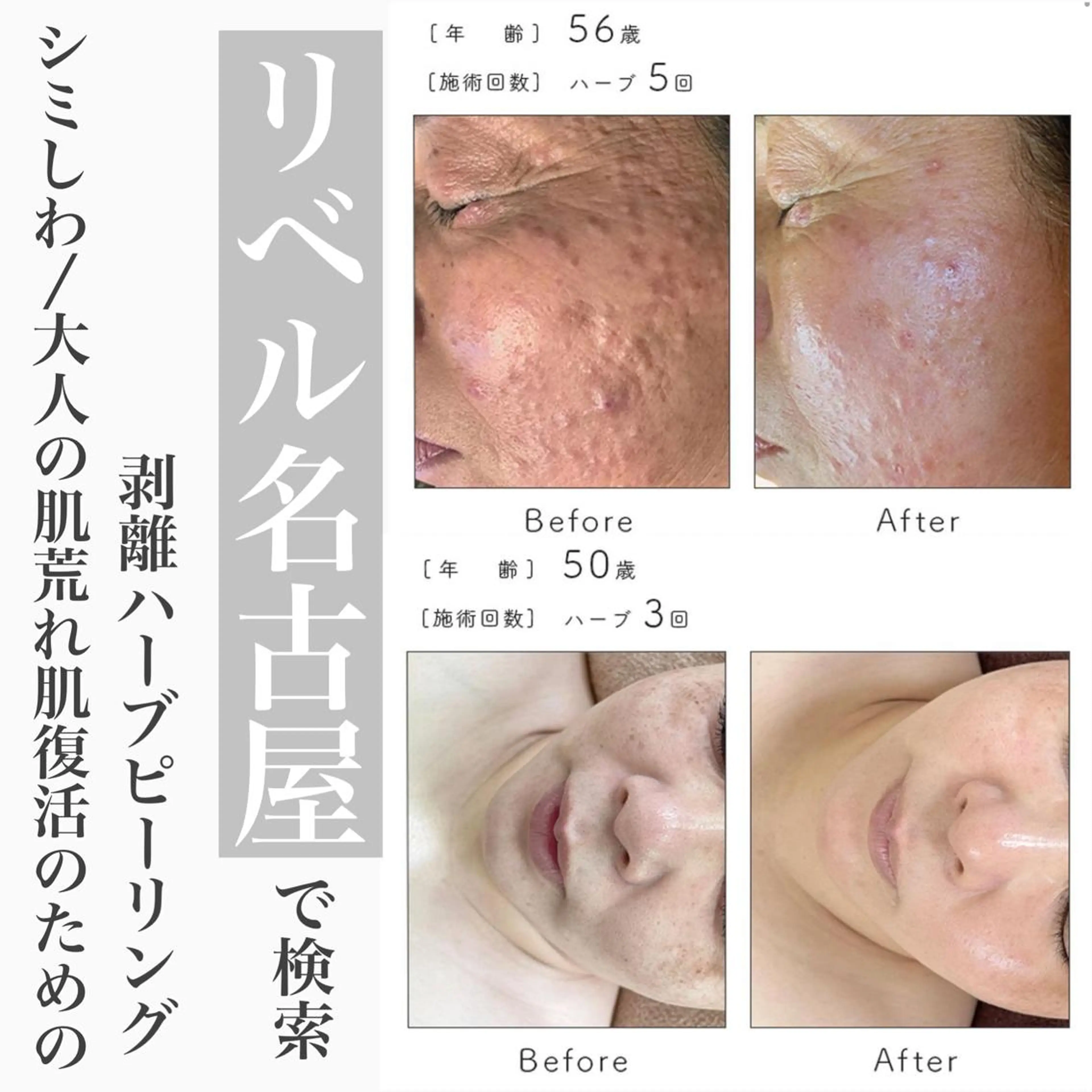 パーマ メンズ マツエク・マツパ エステ 次世代まつげパーマは 『リベル名古屋』のマツエク・マツパデザイン