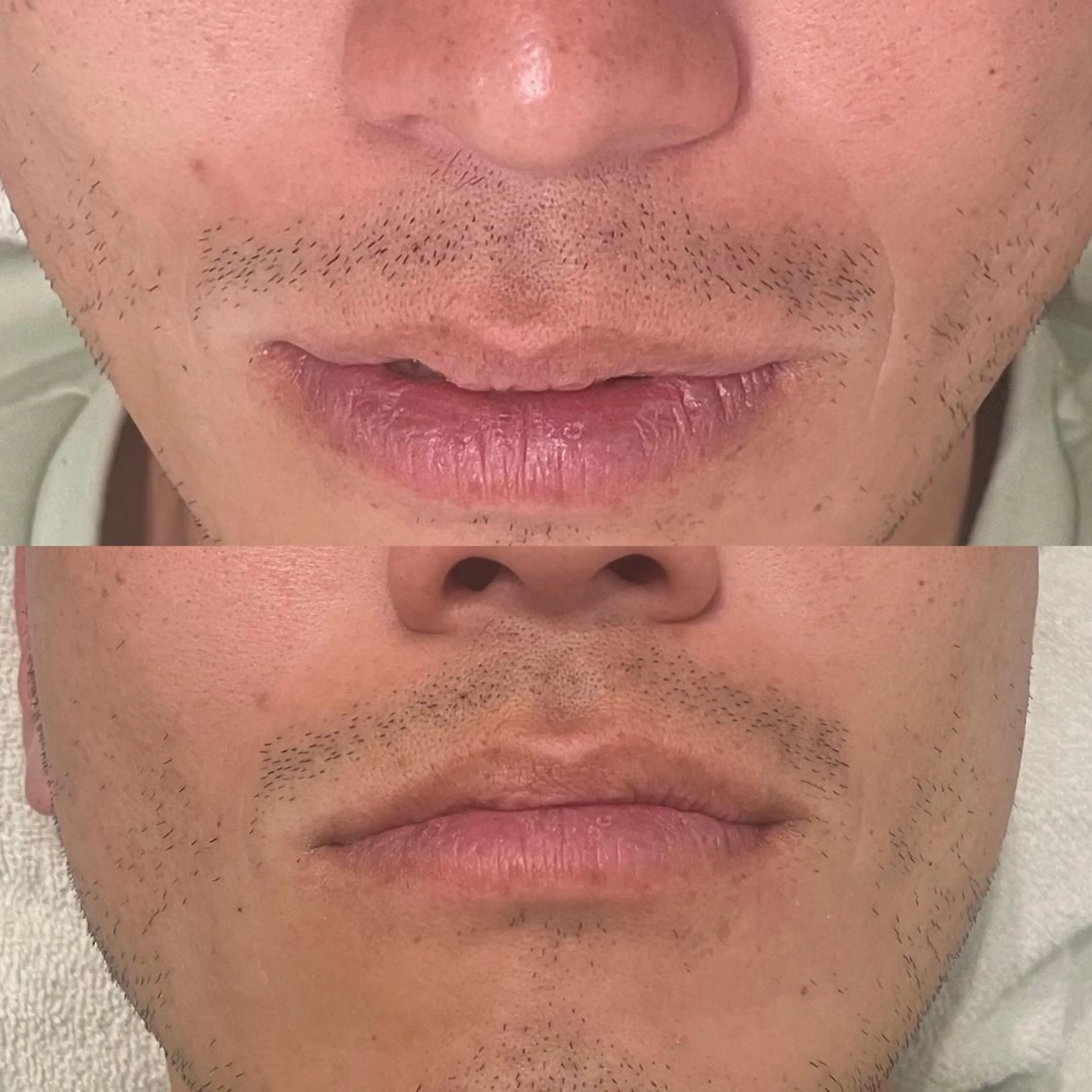 そノさき所属・鍼灸整体専門サロン 島袋のエステ・リラクイメージ