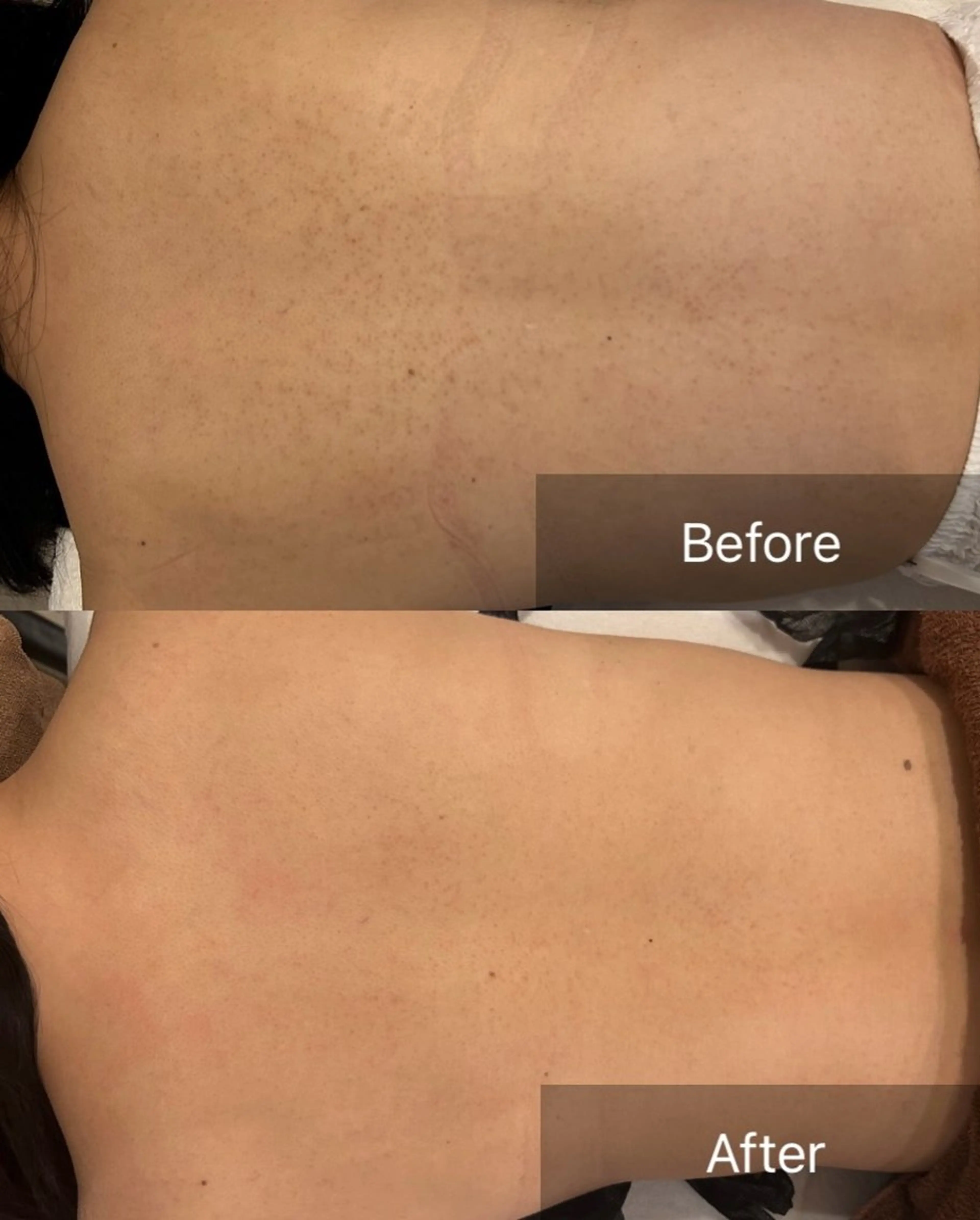 エステ clé skin 🌿ハーブピーリングのエステ・リラクイメージ