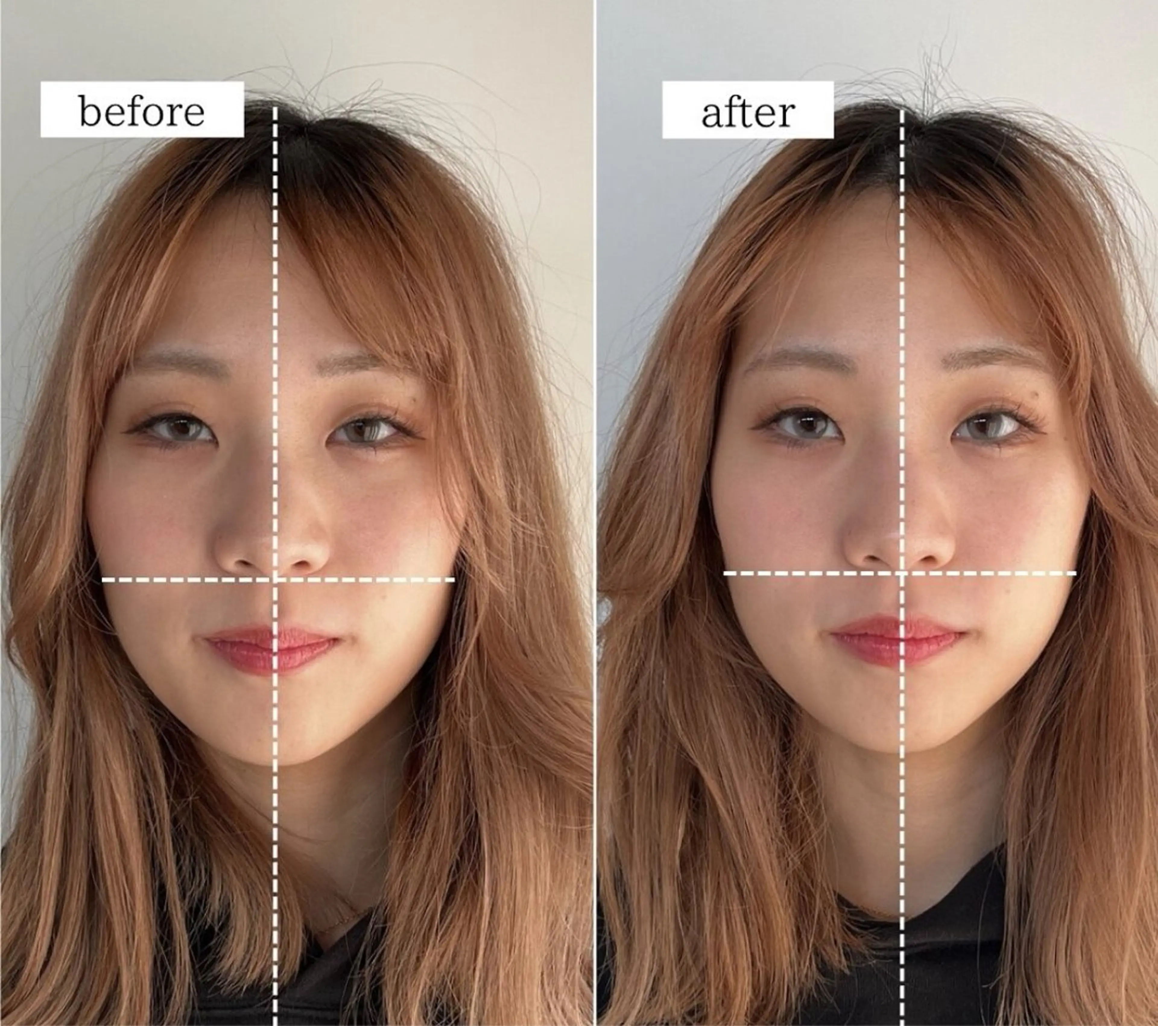 全身矯正(カウンセリング込)の写真