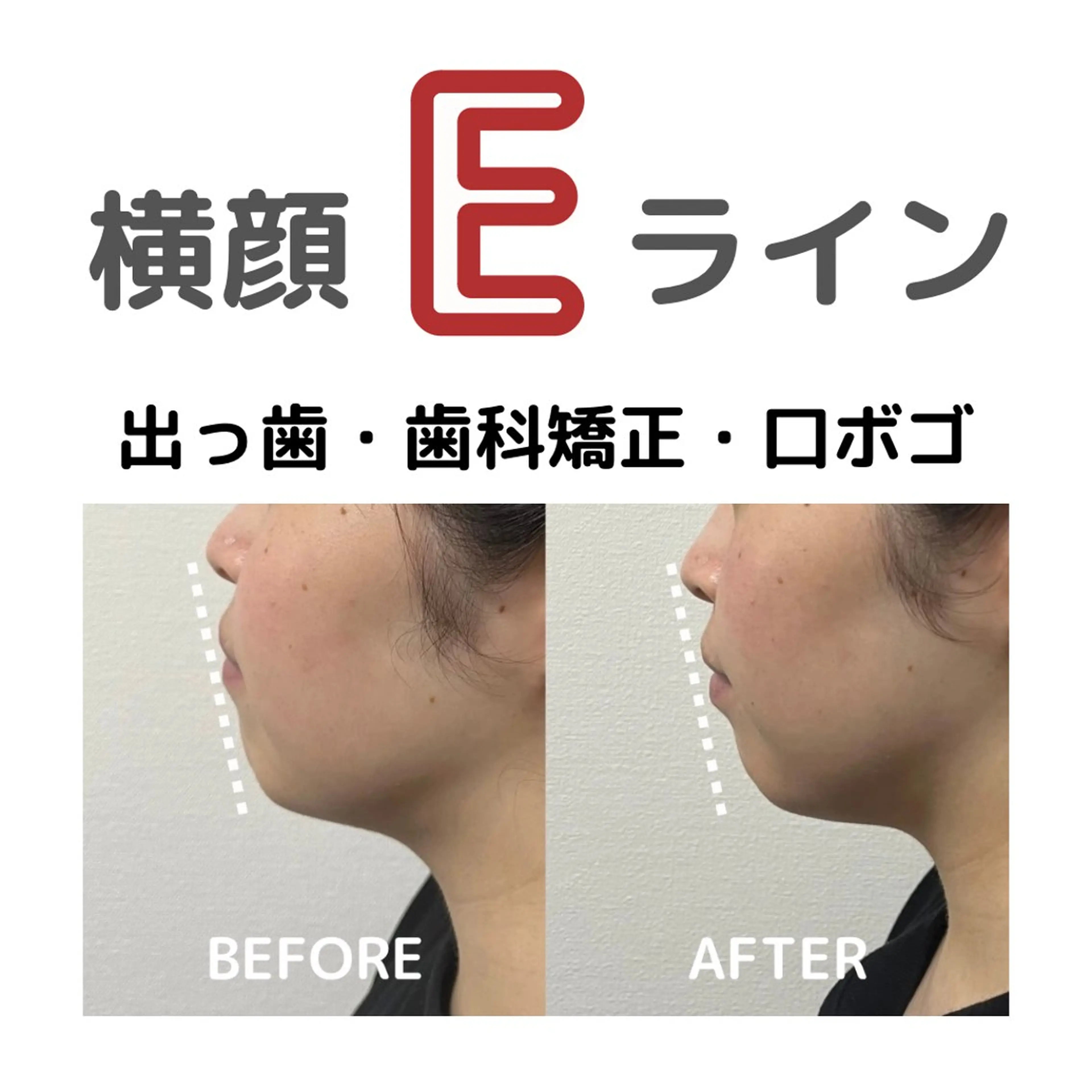 小顔矯正/骨格矯正 AKANEのエステ・リラクイメージ